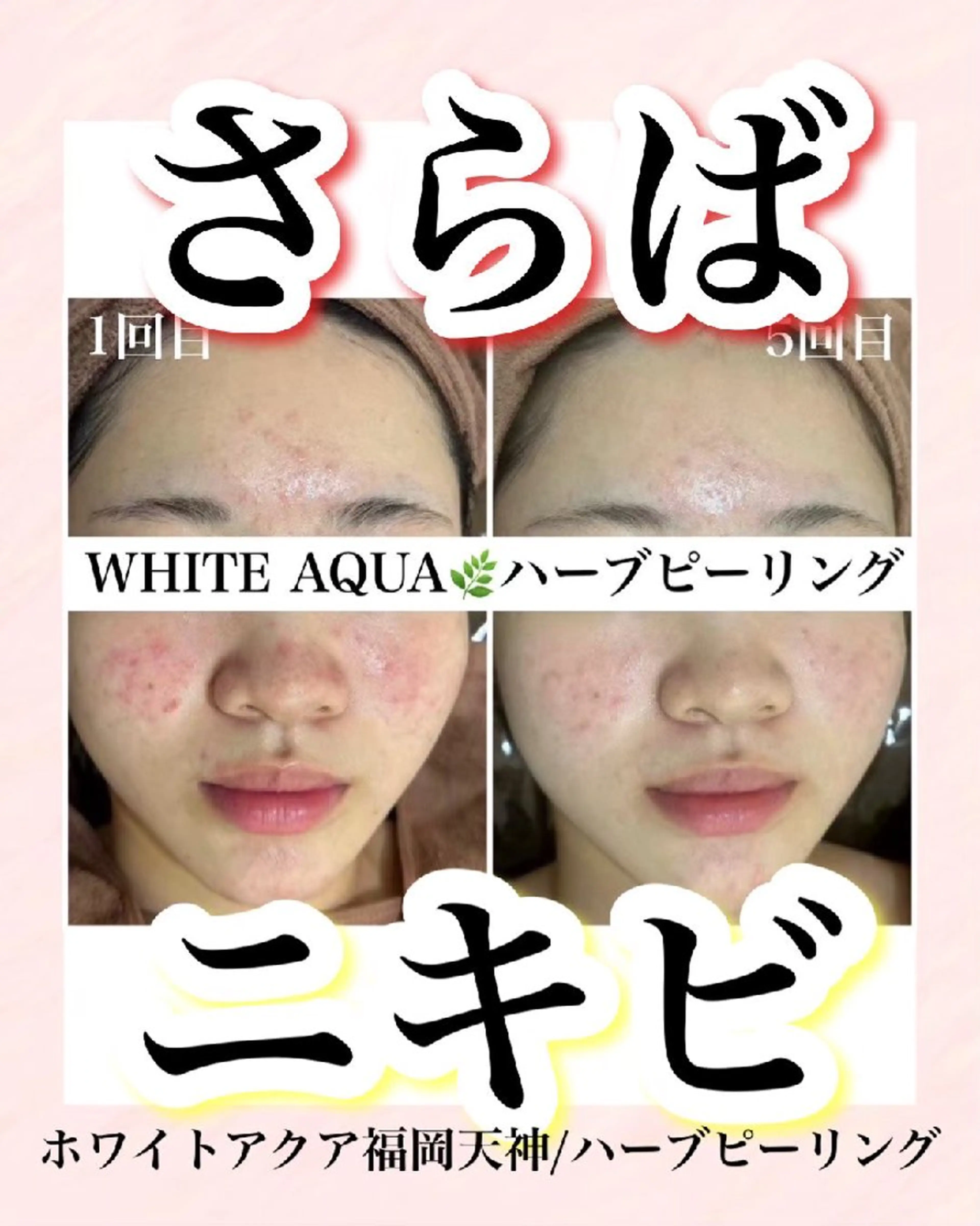 メンズ キッズ WHITEAQUA 福岡天神店のエステ・リラクイメージ