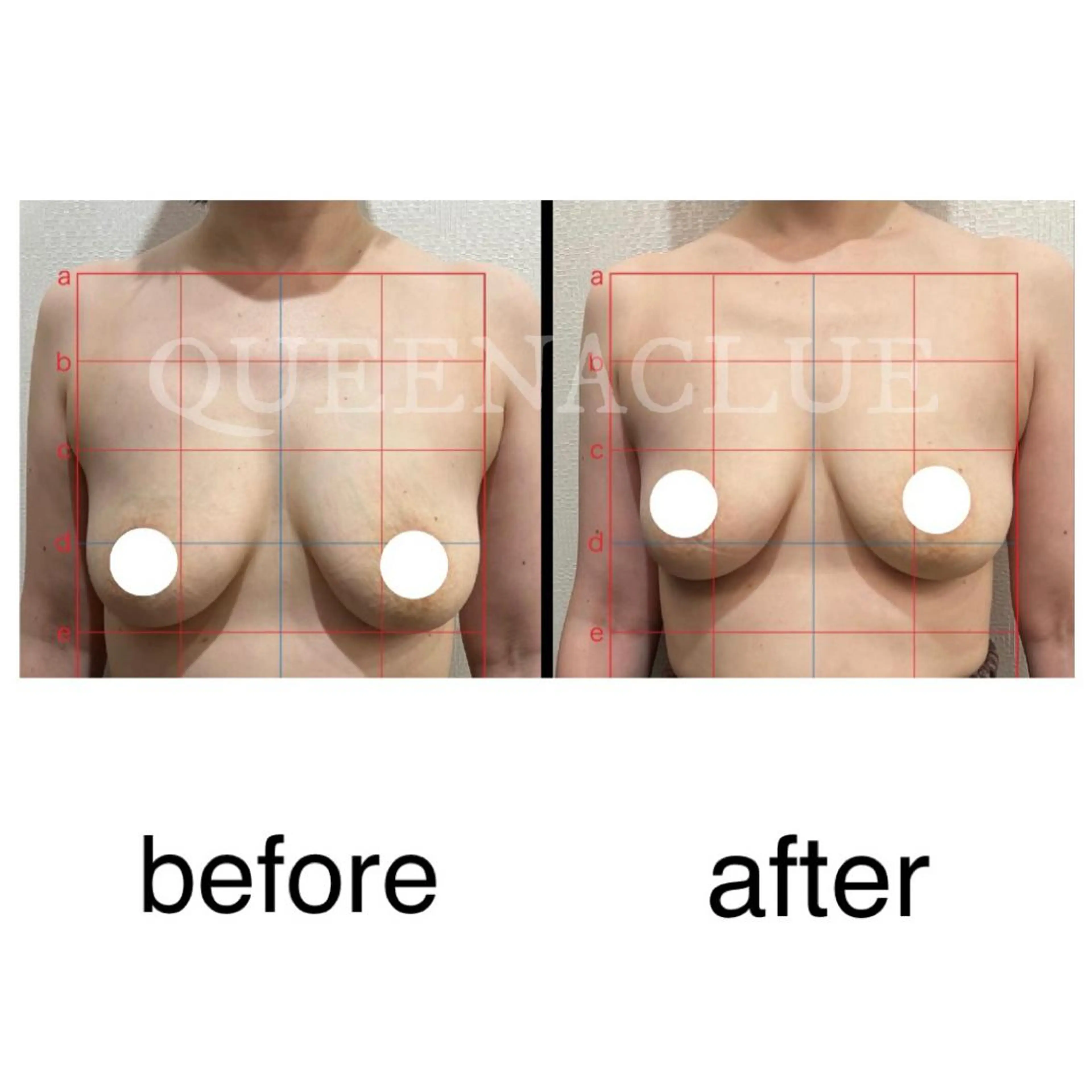 その他 毛穴改善/脱毛 ネイル　川上久仁子のエステ・リラクイメージ