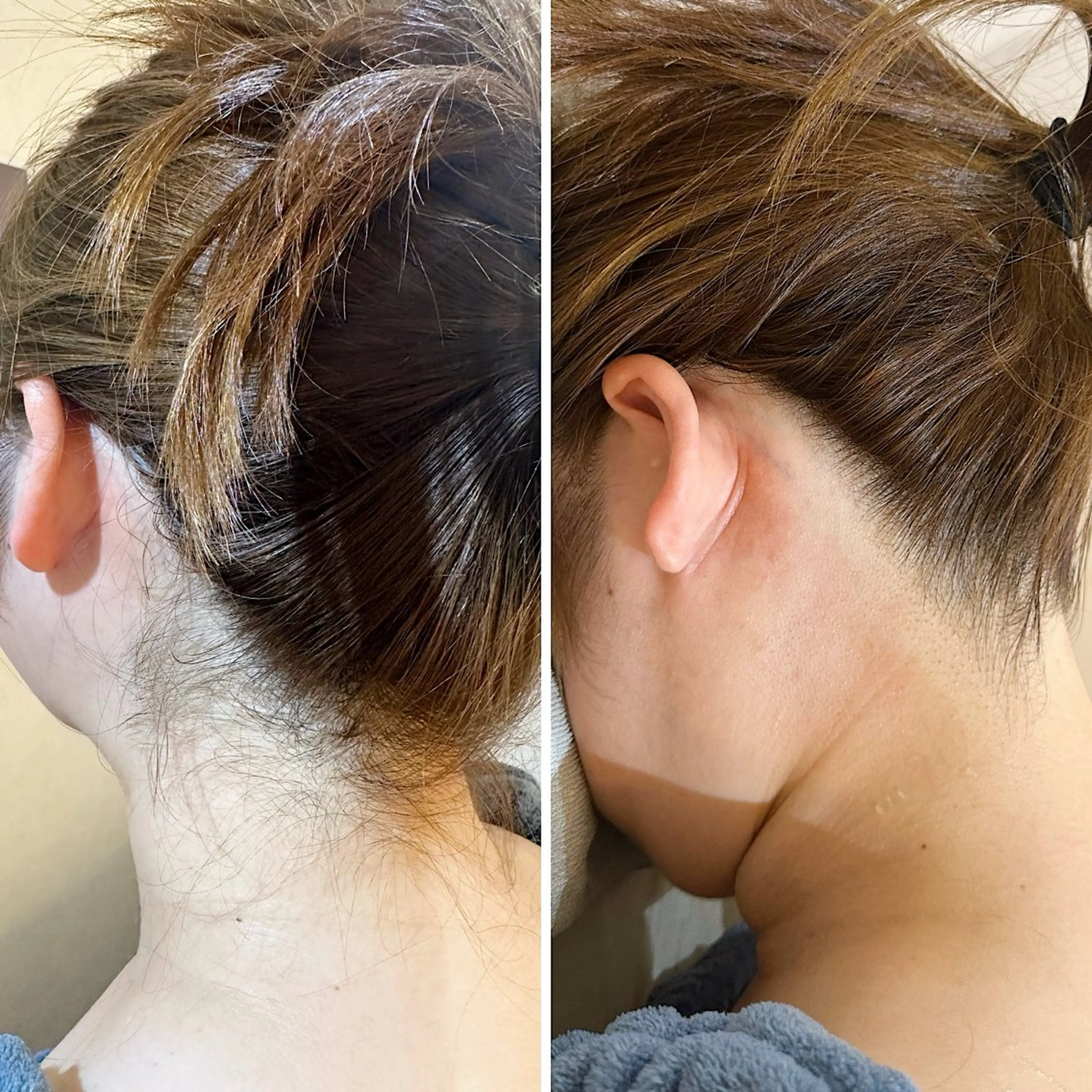 脱毛 うなじ脱毛/美肌脱毛 LABELのエステ・リラクイメージ