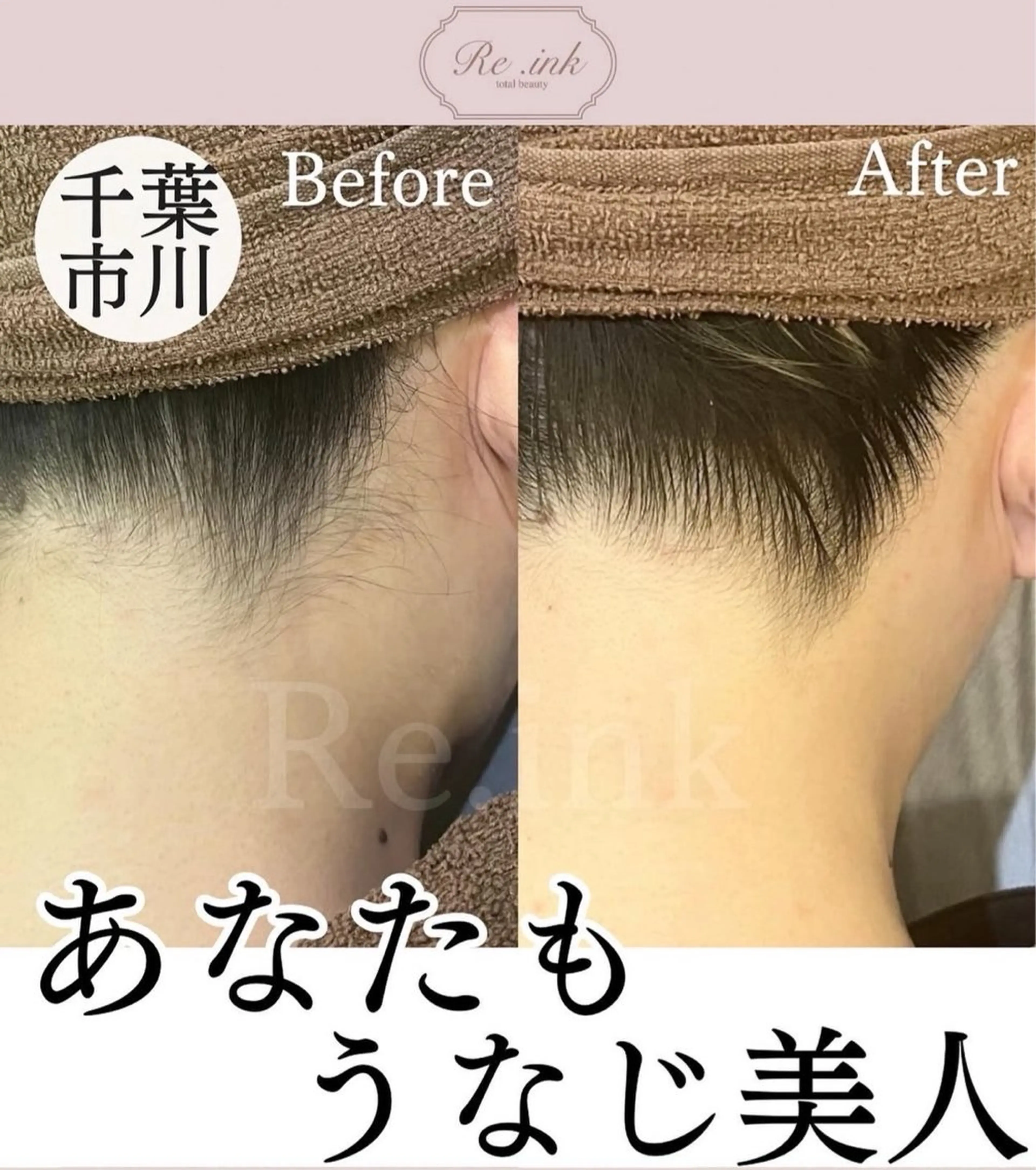 脱毛 関 友希のエステ・リラクイメージ