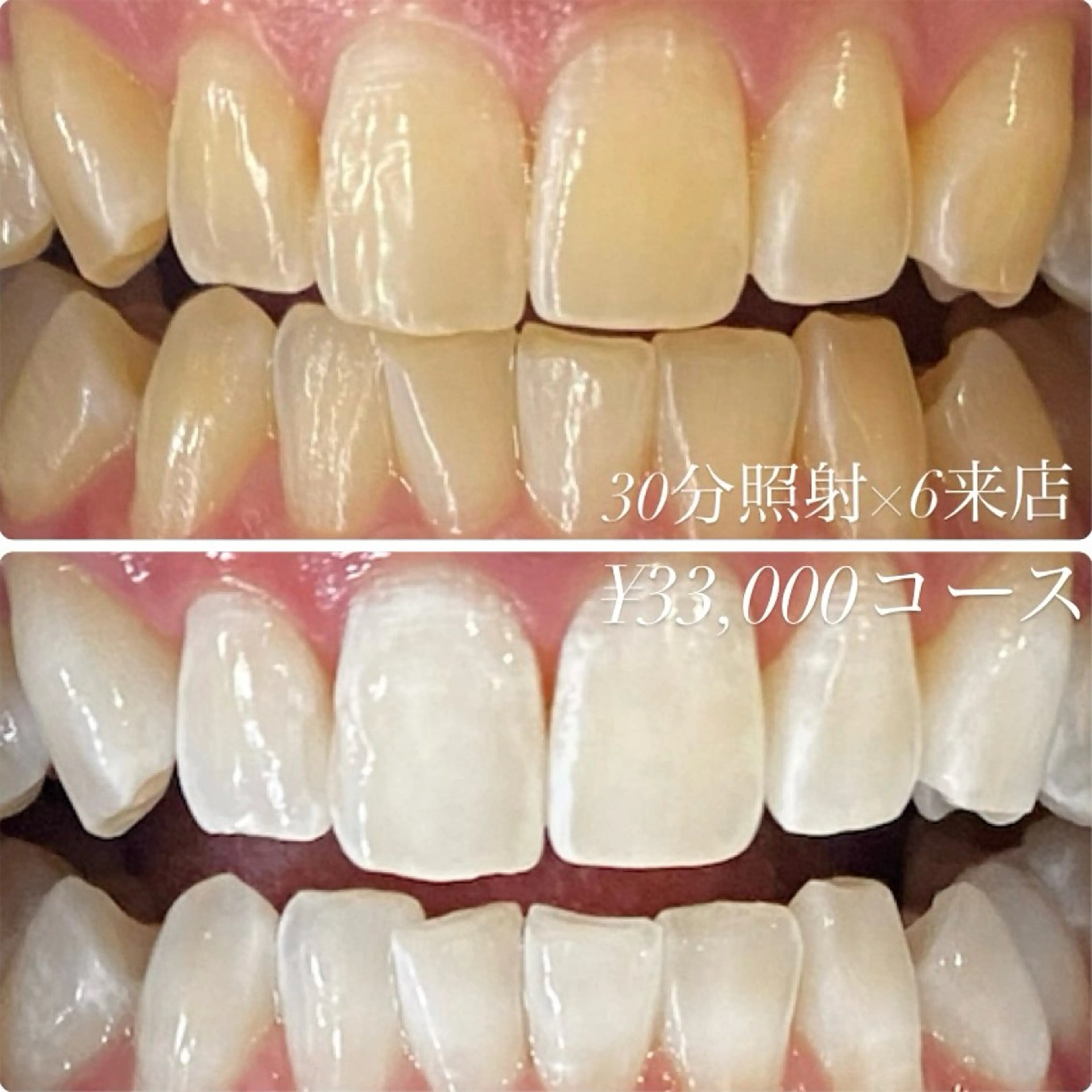 メンズ その他 ホワイトニングルーム　川崎店所属・ホワイトニング ルーム　川崎店のその他イメージ