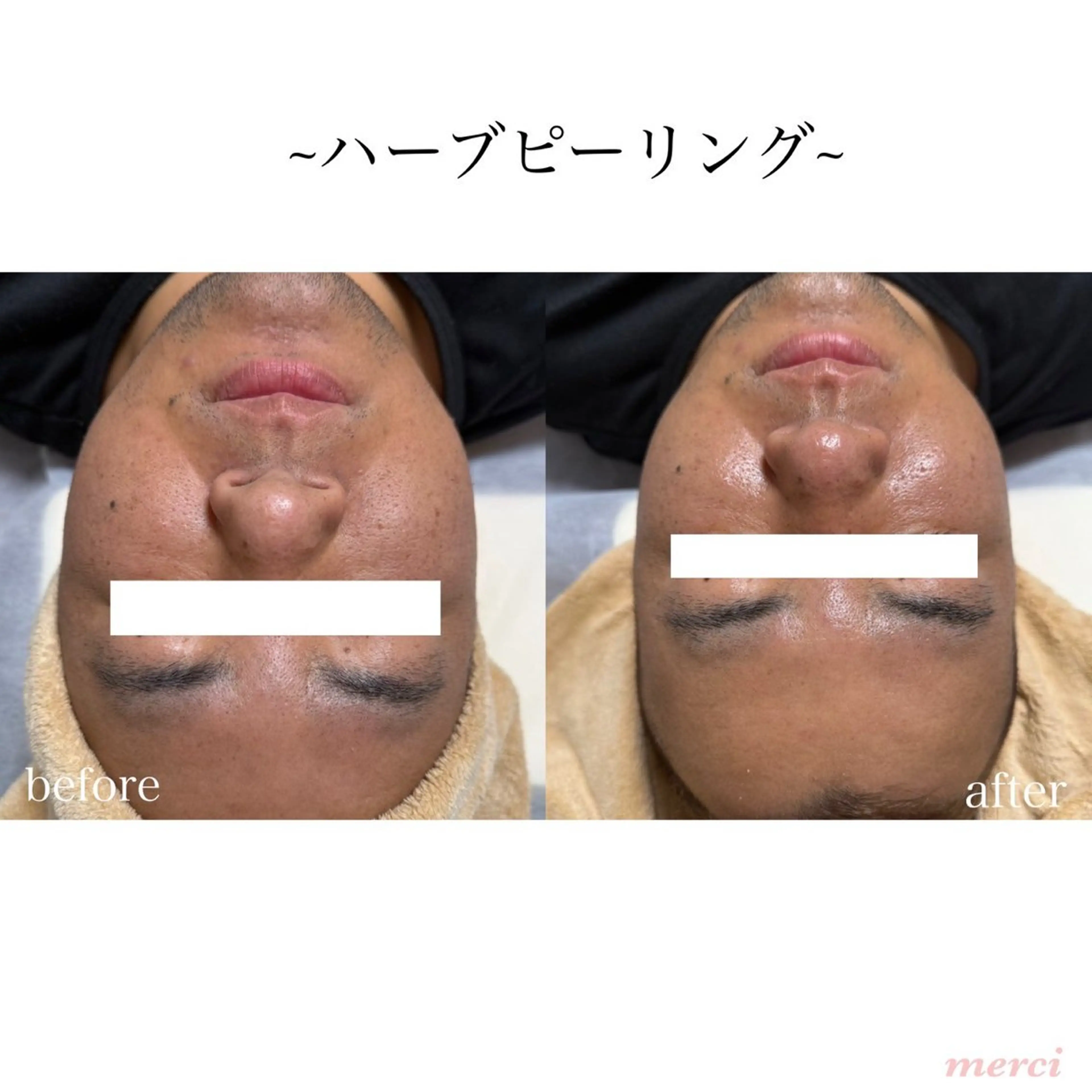 salon merciのエステ・リラクイメージ