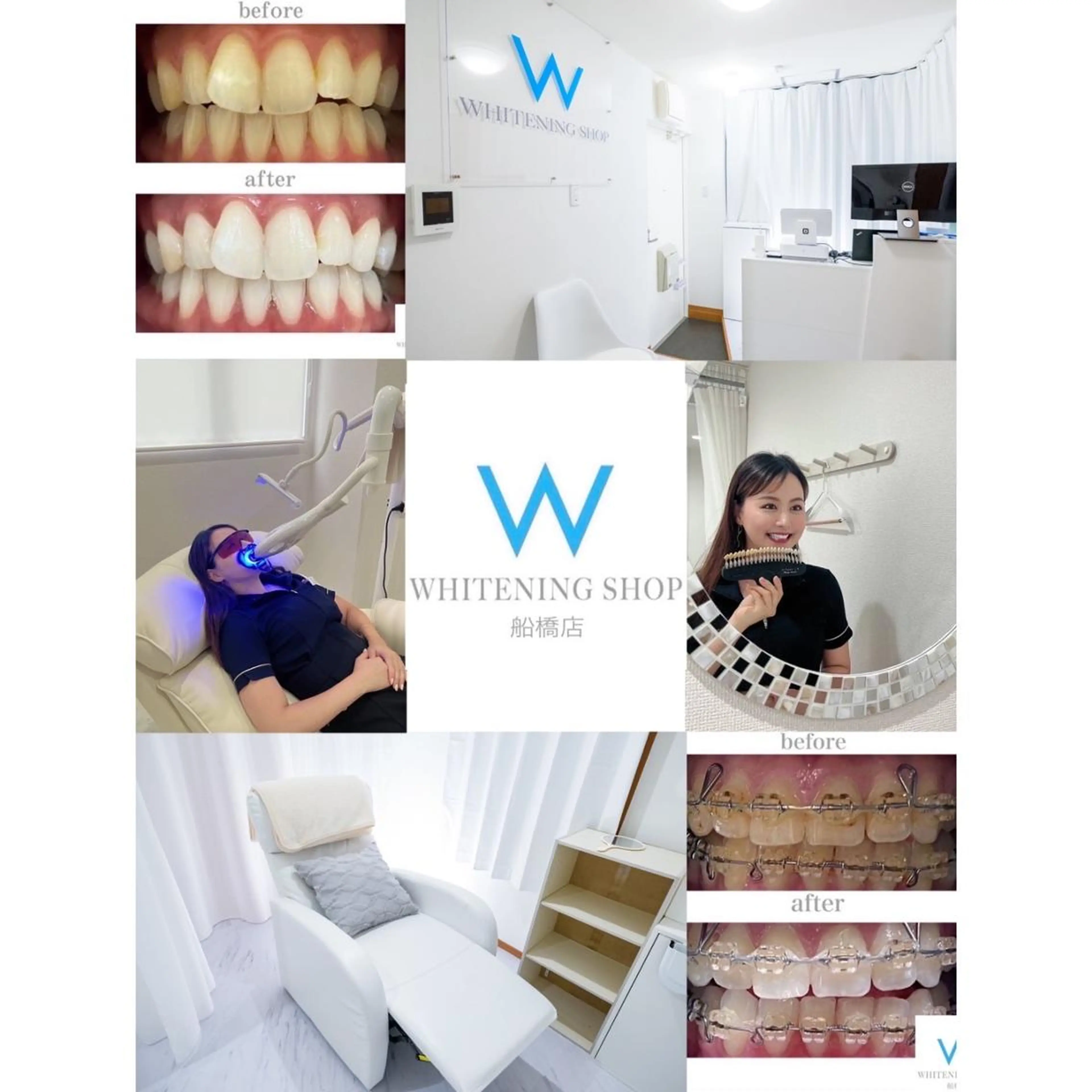 メンズ ホワイトニング ショップ船橋２号店のエステ・リラクイメージ