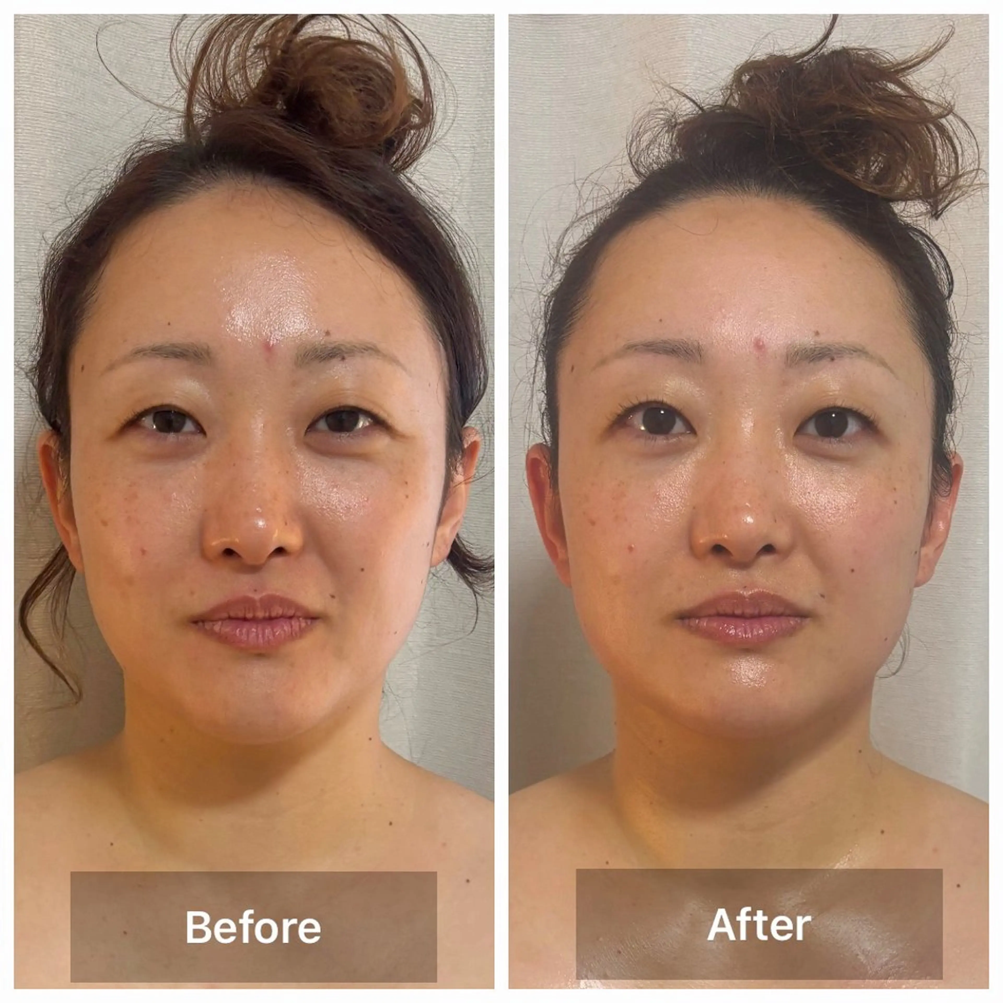 LaLa所属・小顔・たるみケア 専門店【LaLa】のエステ・リラクイメージ