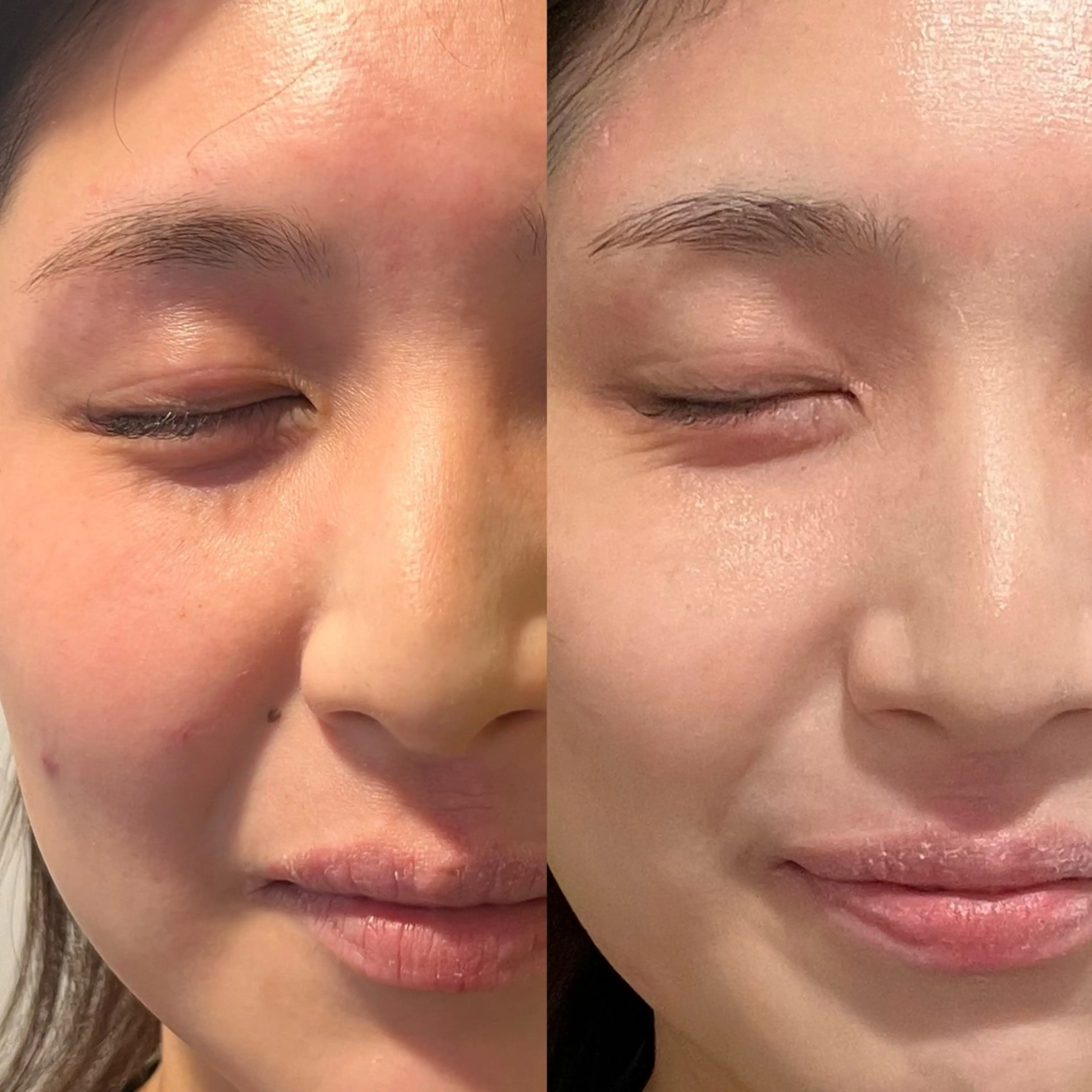 デ・アイム心斎橋所属・肌質改善サロン🫧 MAIのエステ・リラクイメージ