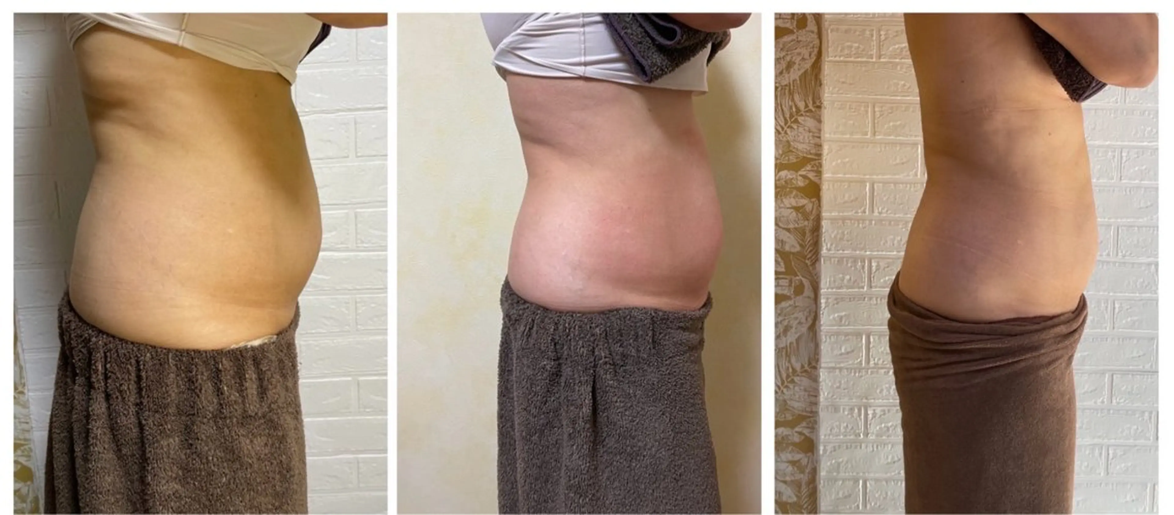 リラク M MaKe yourself shine所属・プライベート脱毛 Jr久宝寺のエステ・リラクイメージ