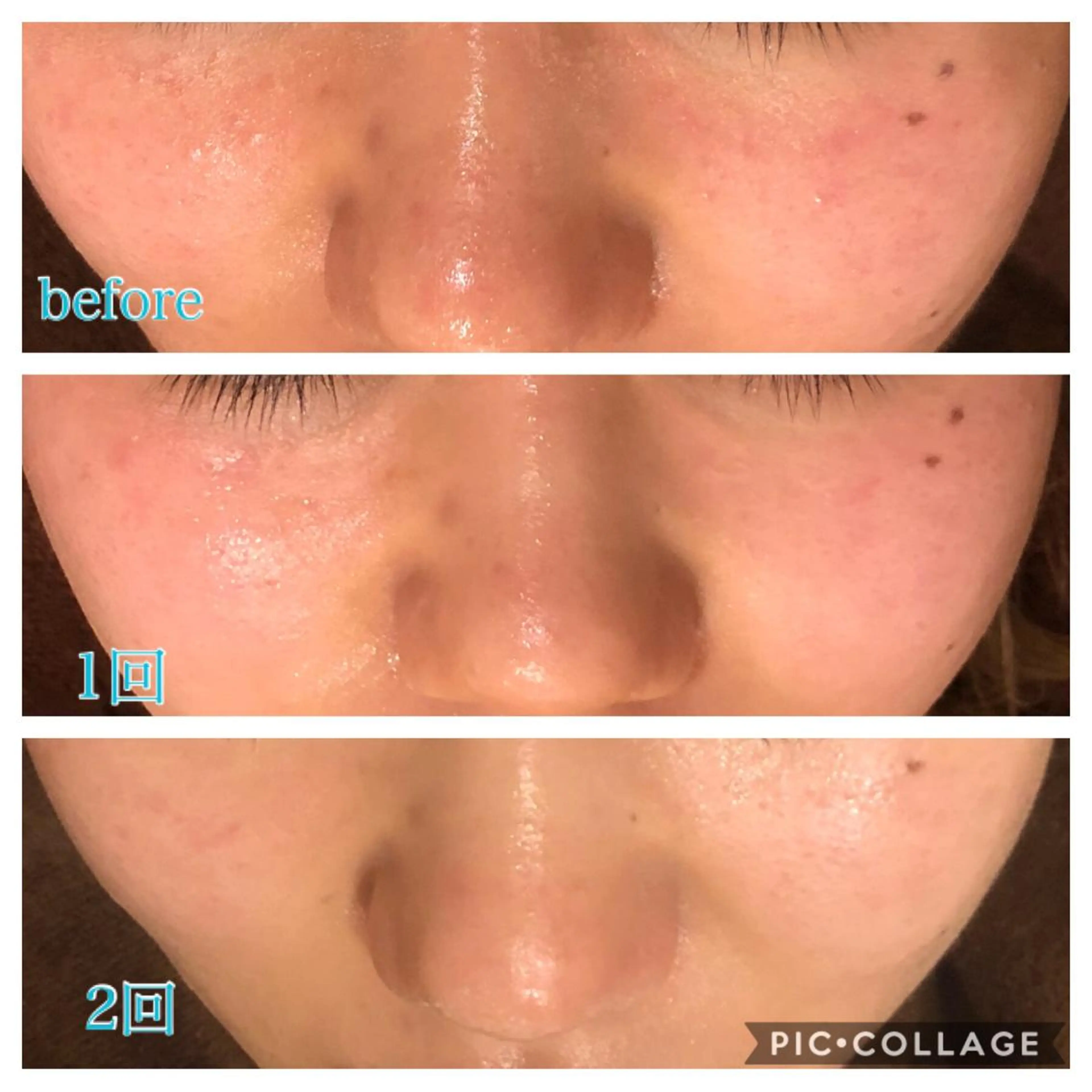 セミロング カラー パーマ ヘアアレンジ キッズ ネイル マツエク・マツパ エステ リラク Ensor Clair所属・EnsorClair 代表　野口真央のエステ・リラクイメージ