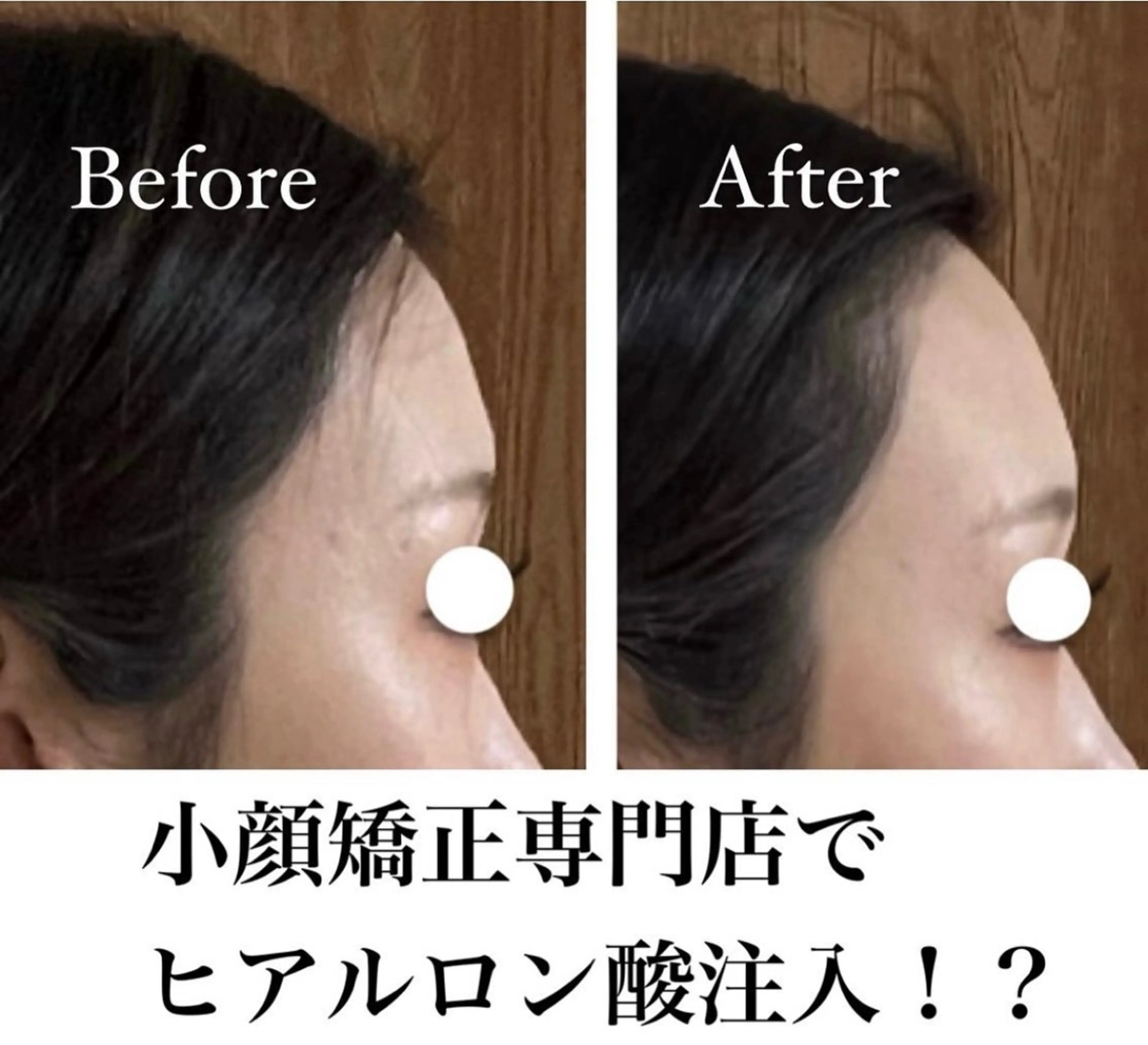 La　Beaute Verite所属・浅居 結菜のその他イメージ
