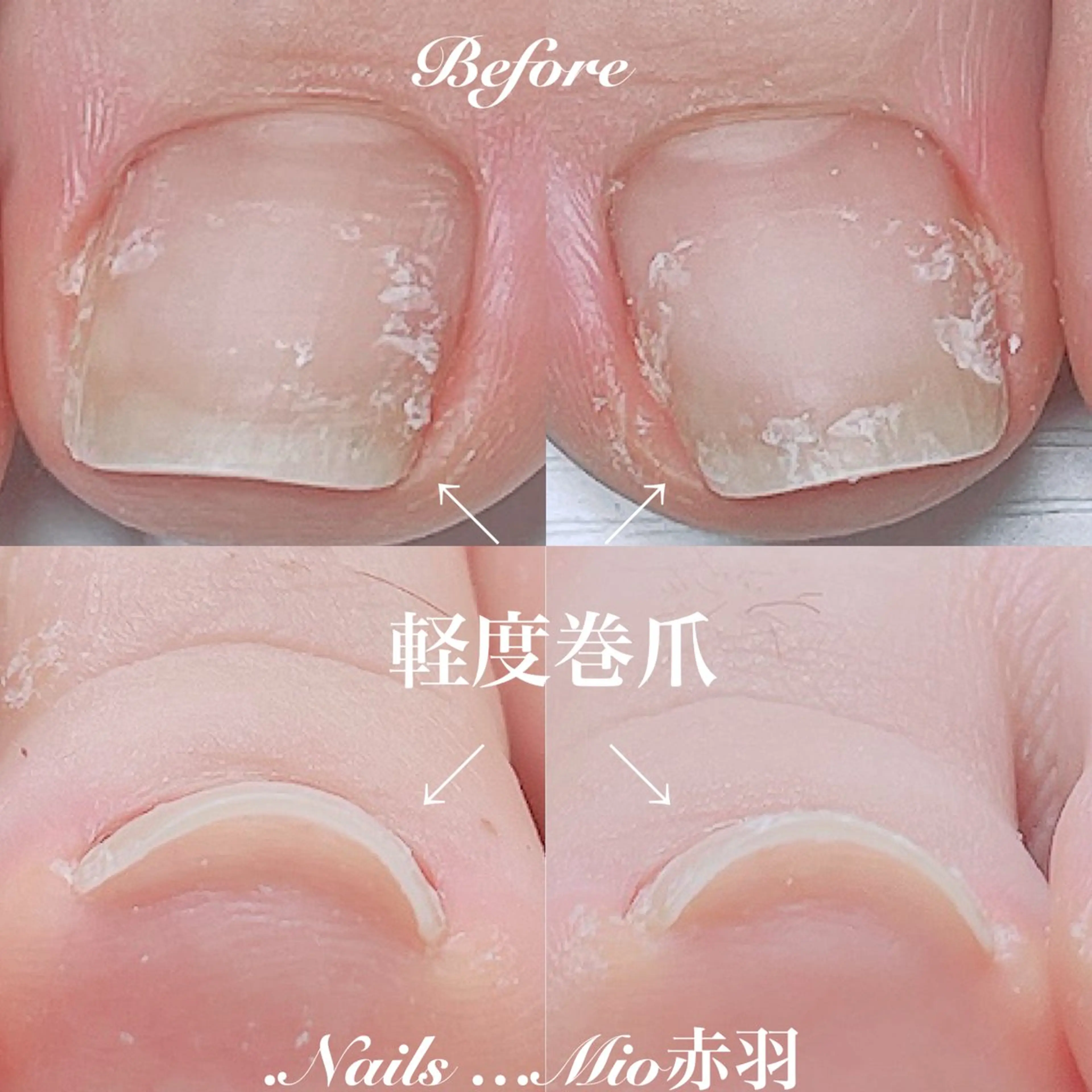 ネイル フットネイル .Nails Mio 赤羽西ネイルサロンのネイルデザイン