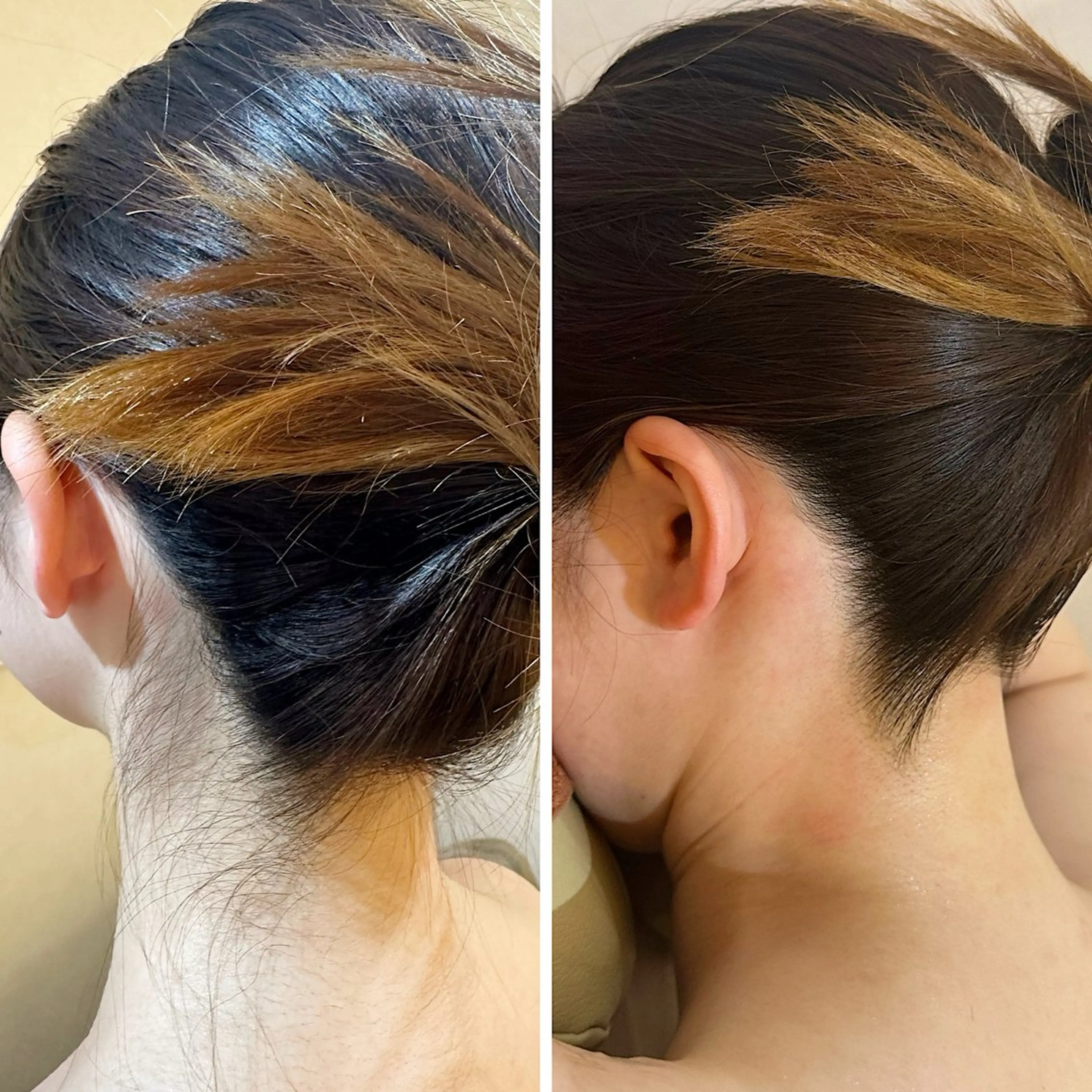 脱毛 うなじ脱毛/美肌脱毛 LABELのエステ・リラクイメージ