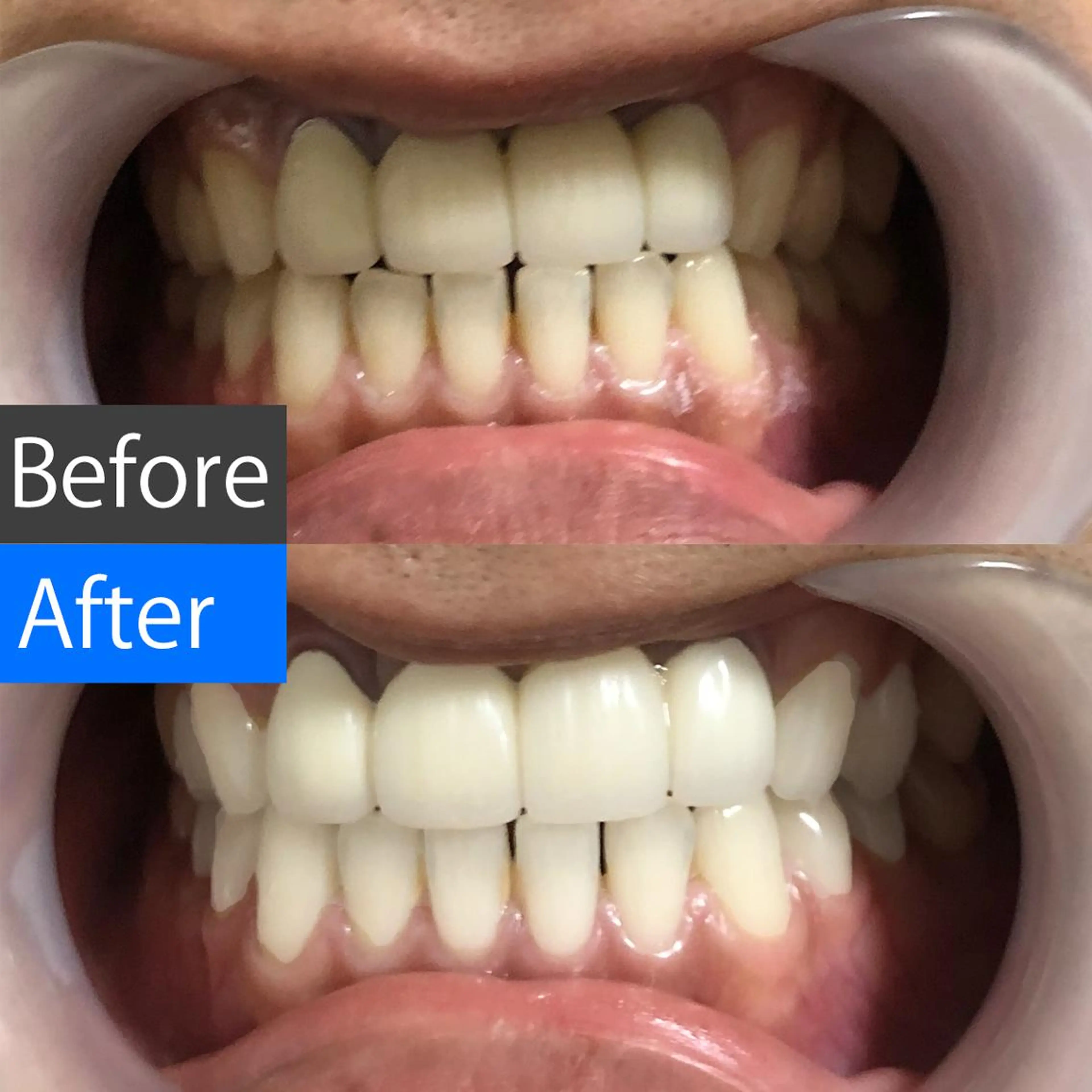 ロング メンズ アイブロウ ヘアアレンジ パーマ ネイル キッズ 結婚式・ブライダル メンズ就活ヘア オフィスネイル ブライダルネイル ホワイト 中目黒 ホワイトニングサロンのその他イメージ