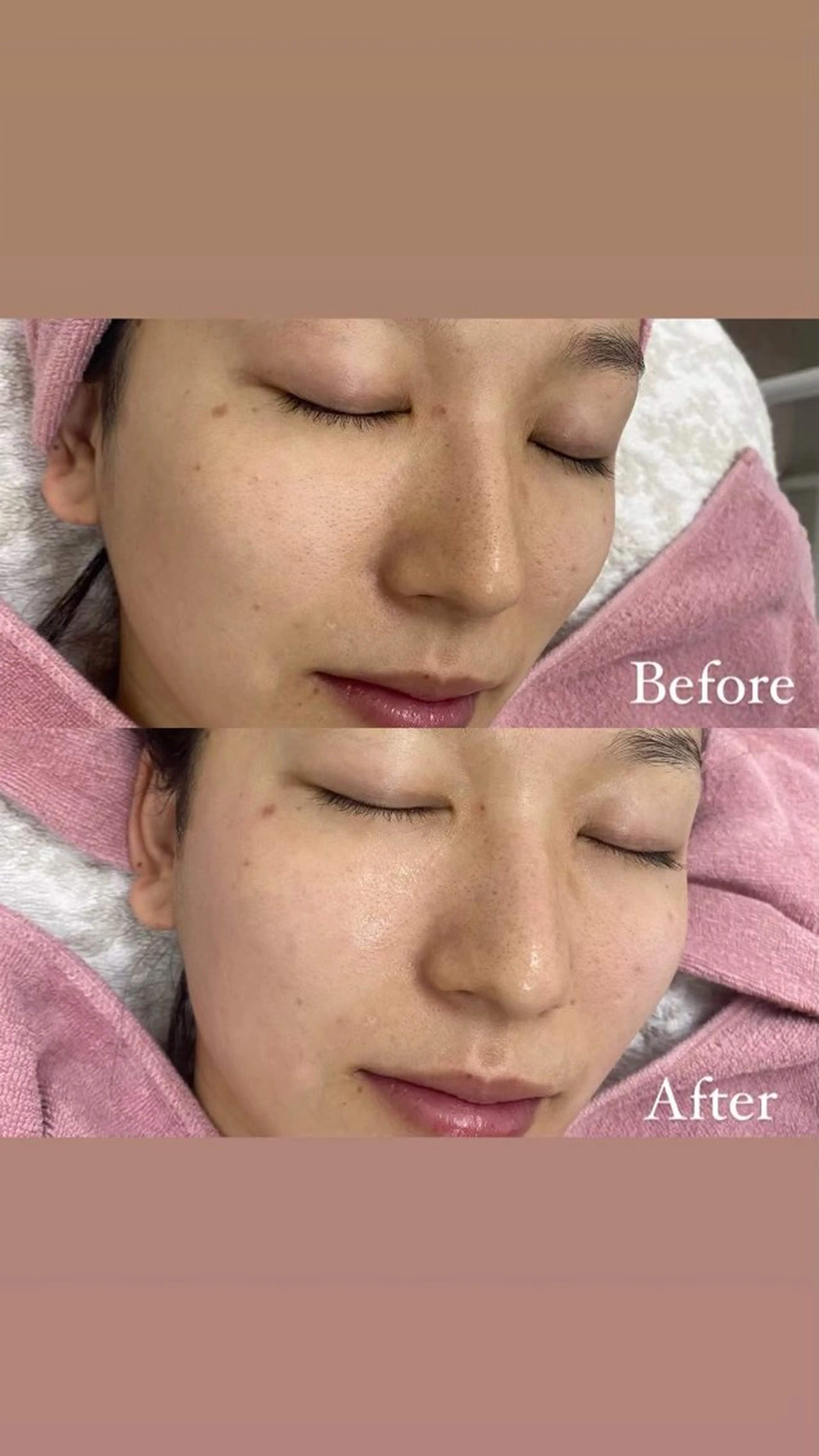 siro スタッフのエステ・リラクイメージ