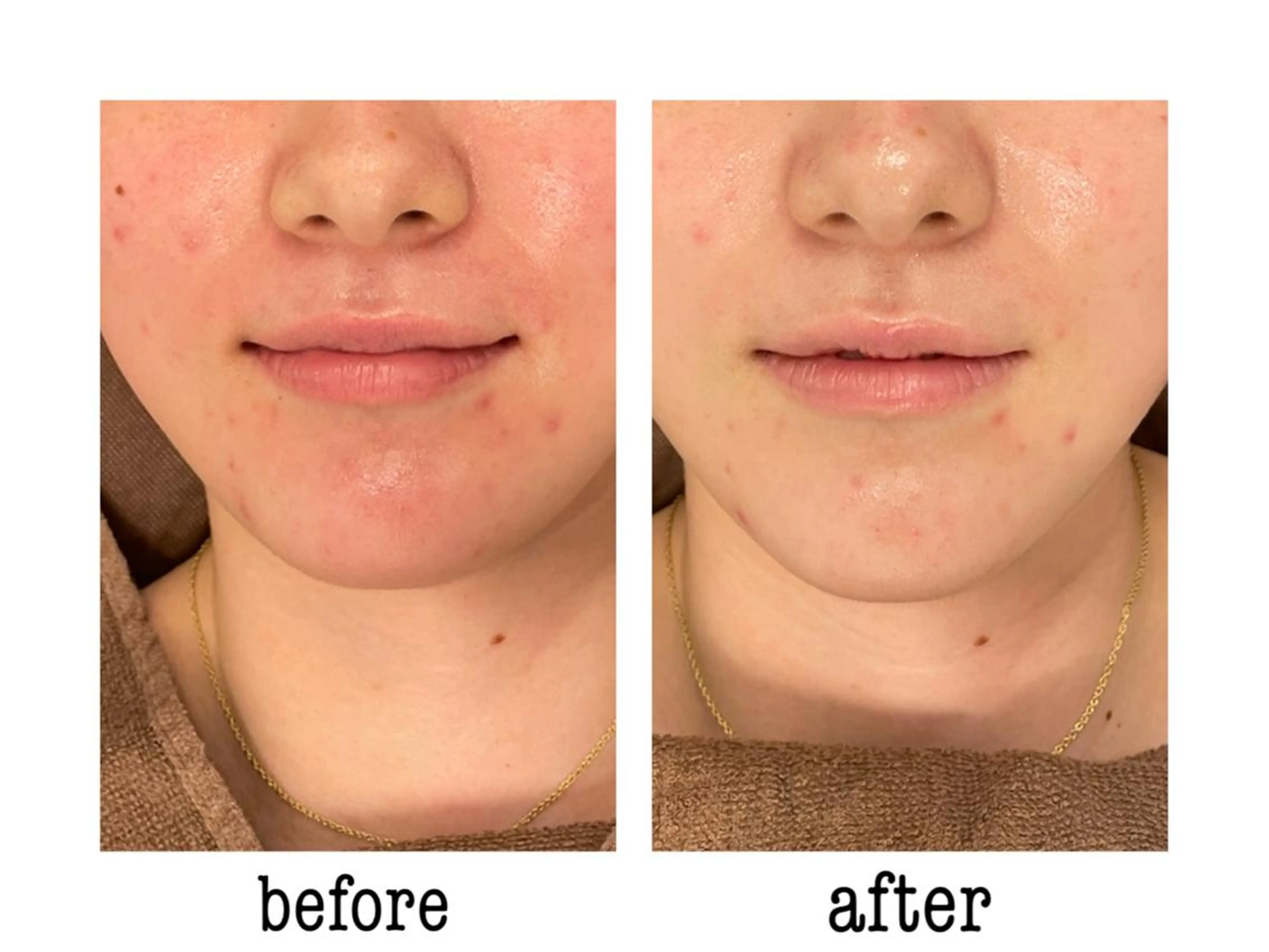 エステ 🦋美肌サロン. maho🦋のエステ・リラクイメージ