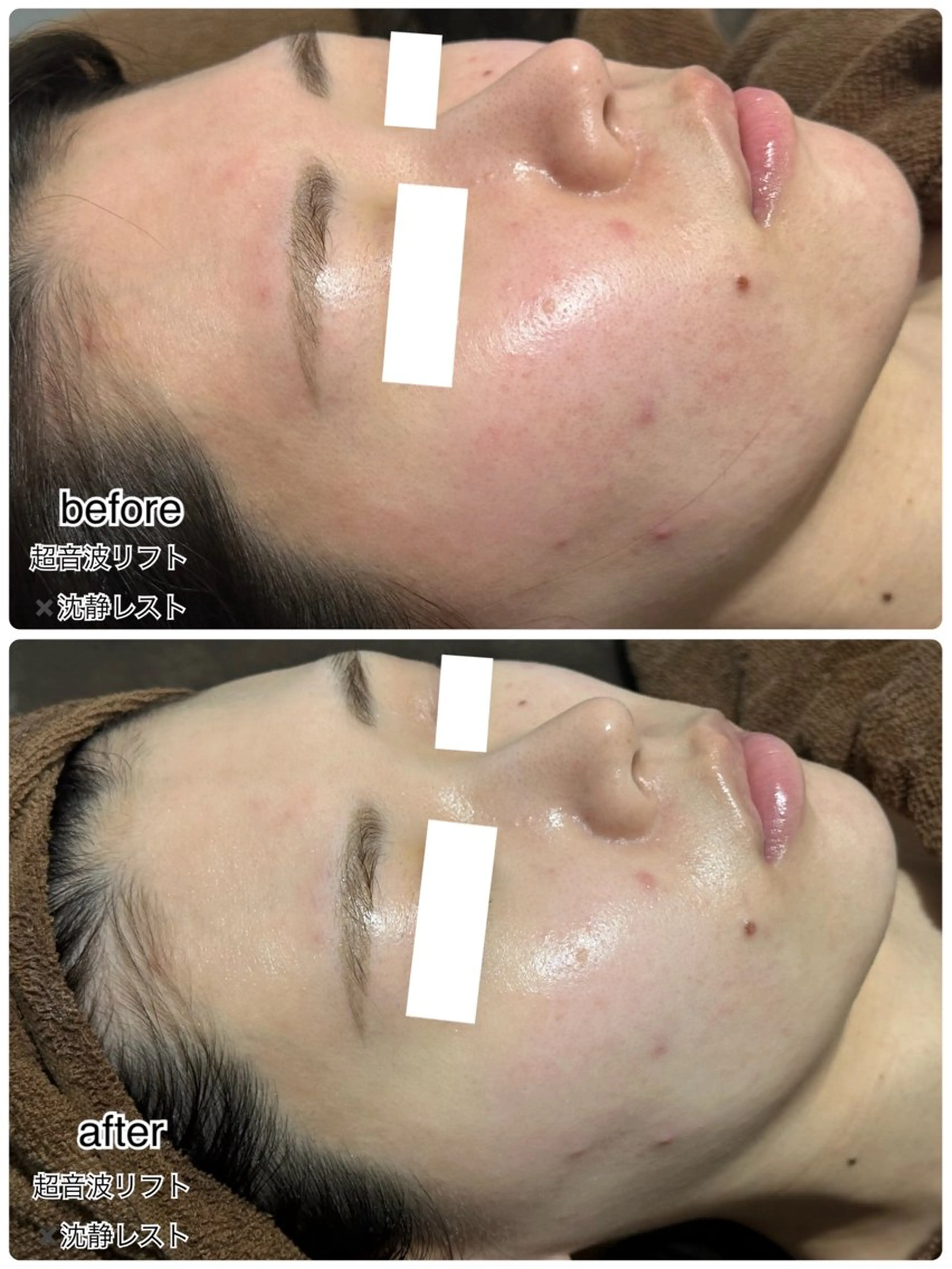 エステ ENCHANT 脱毛.小顔.毛穴のエステ・リラクイメージ