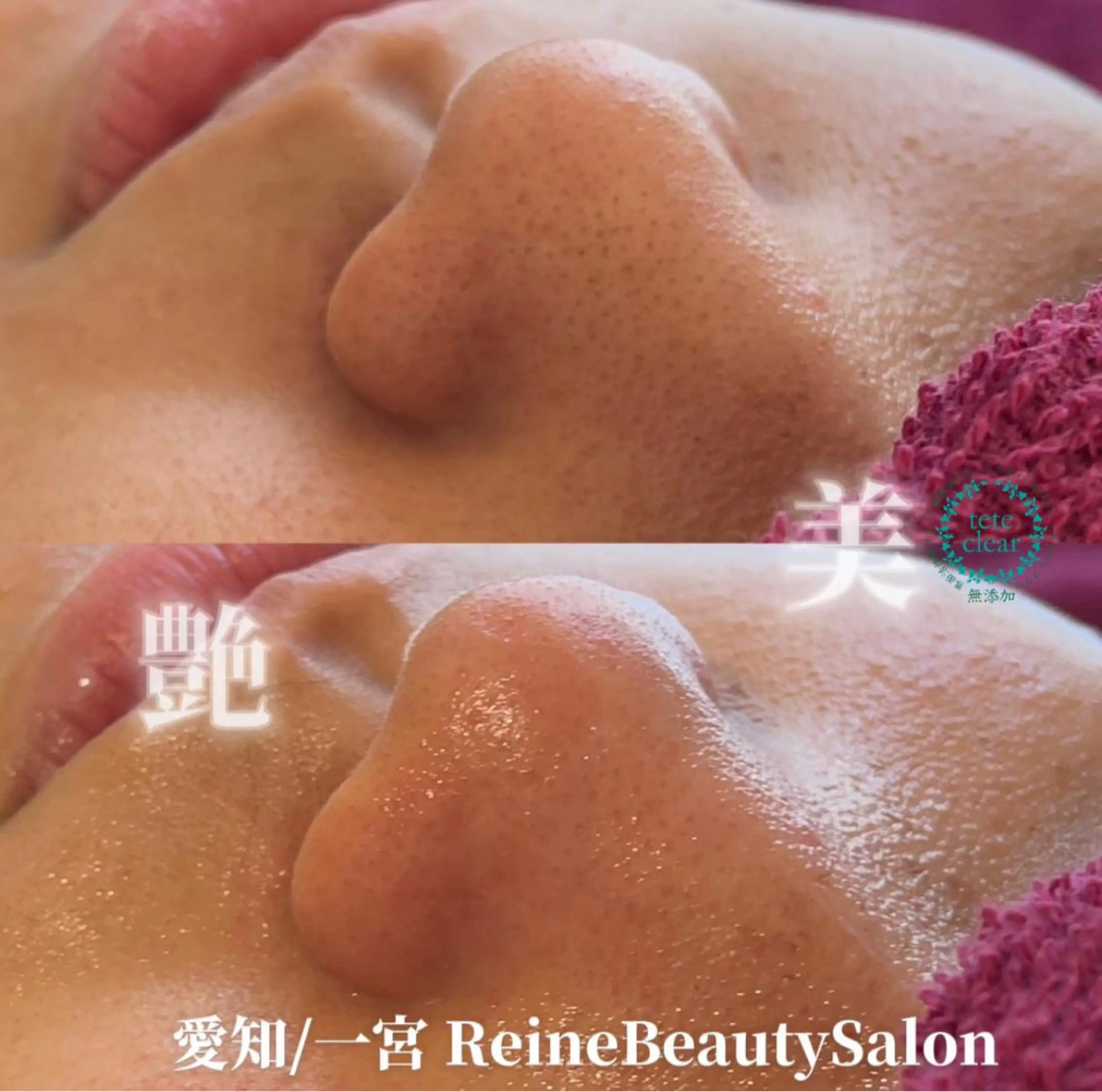 エステ Reine BeautySalon所属・毛穴/シミ肝斑/脱毛 横山梨里のエステ・リラクイメージ