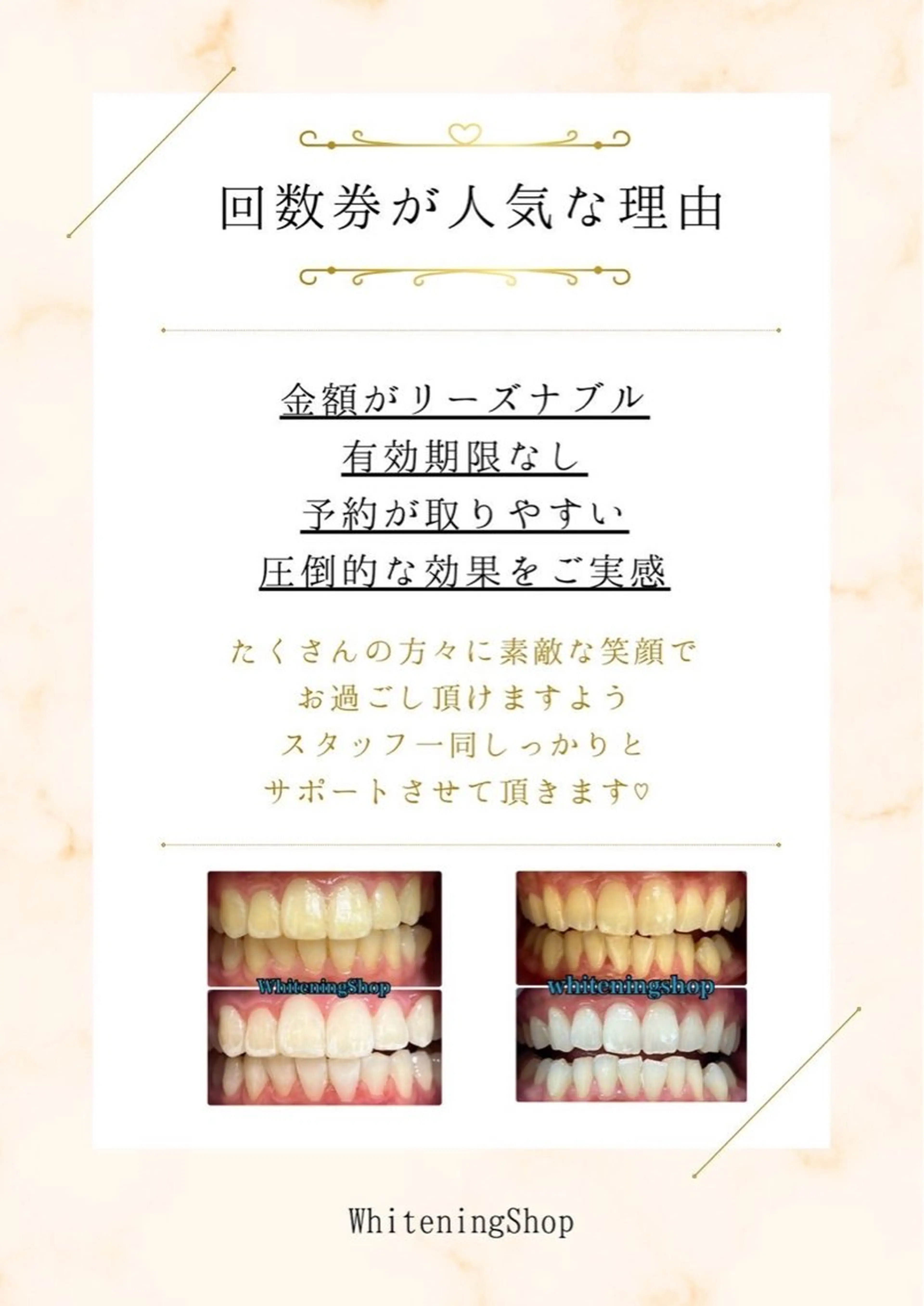 その他 ホワイトニングショップ静岡葵区店所属・ホワイトニング ショップ静岡葵区店のその他イメージ