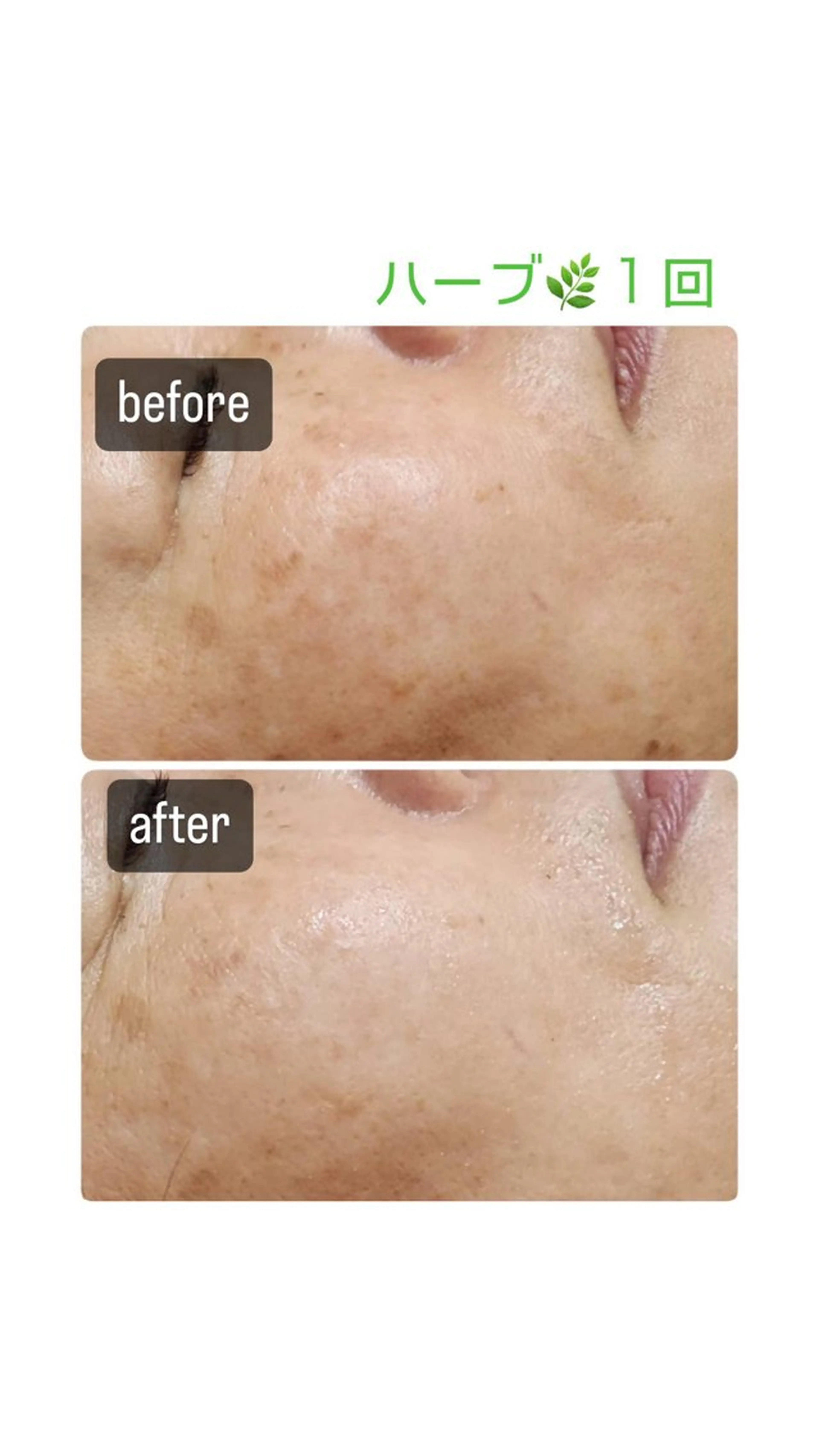 志免町 フェイスシャルエステのエステ・リラクイメージ