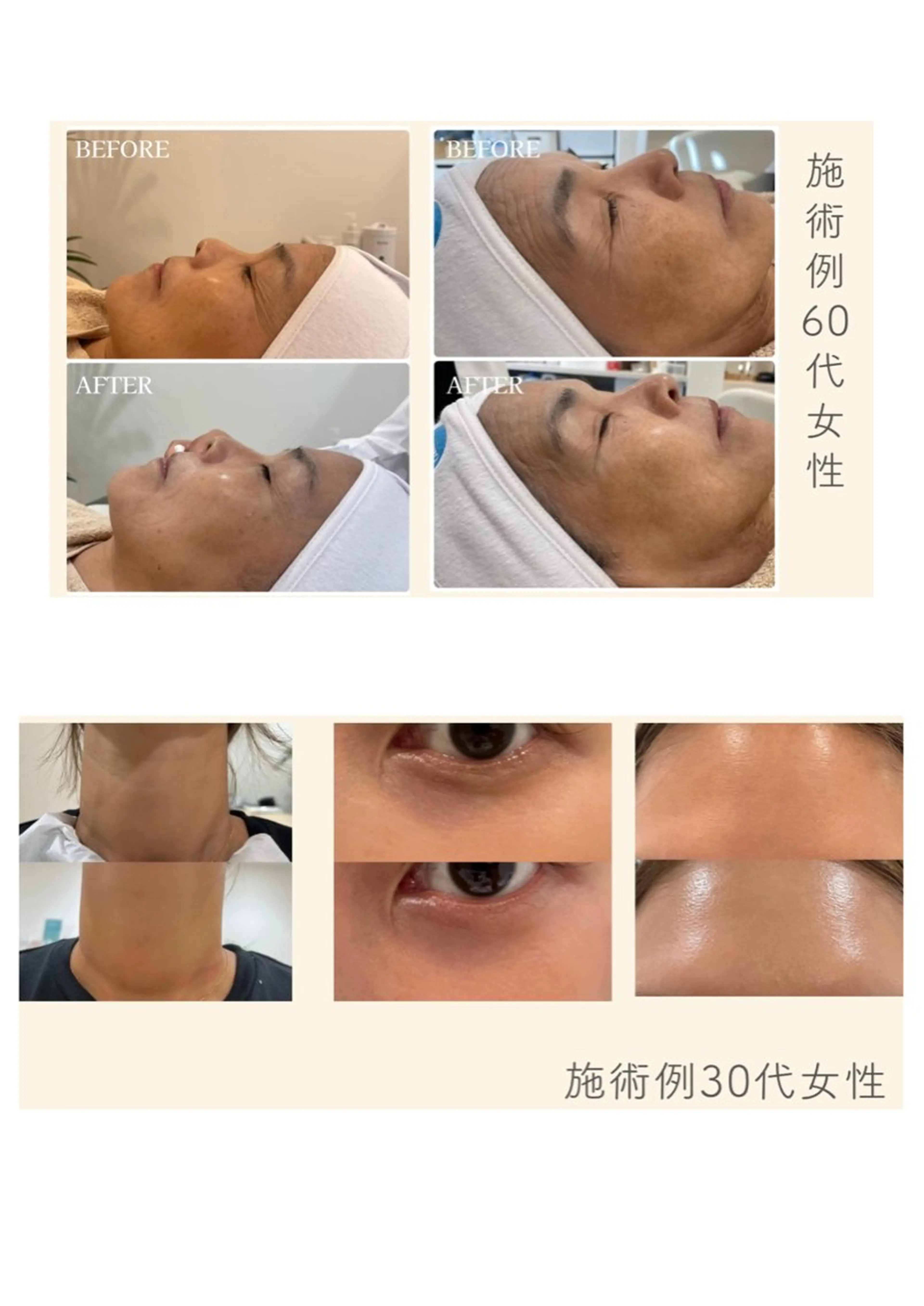 Petila所属・Petila千葉🫧 Ａｙａｋａのエステ・リラクイメージ