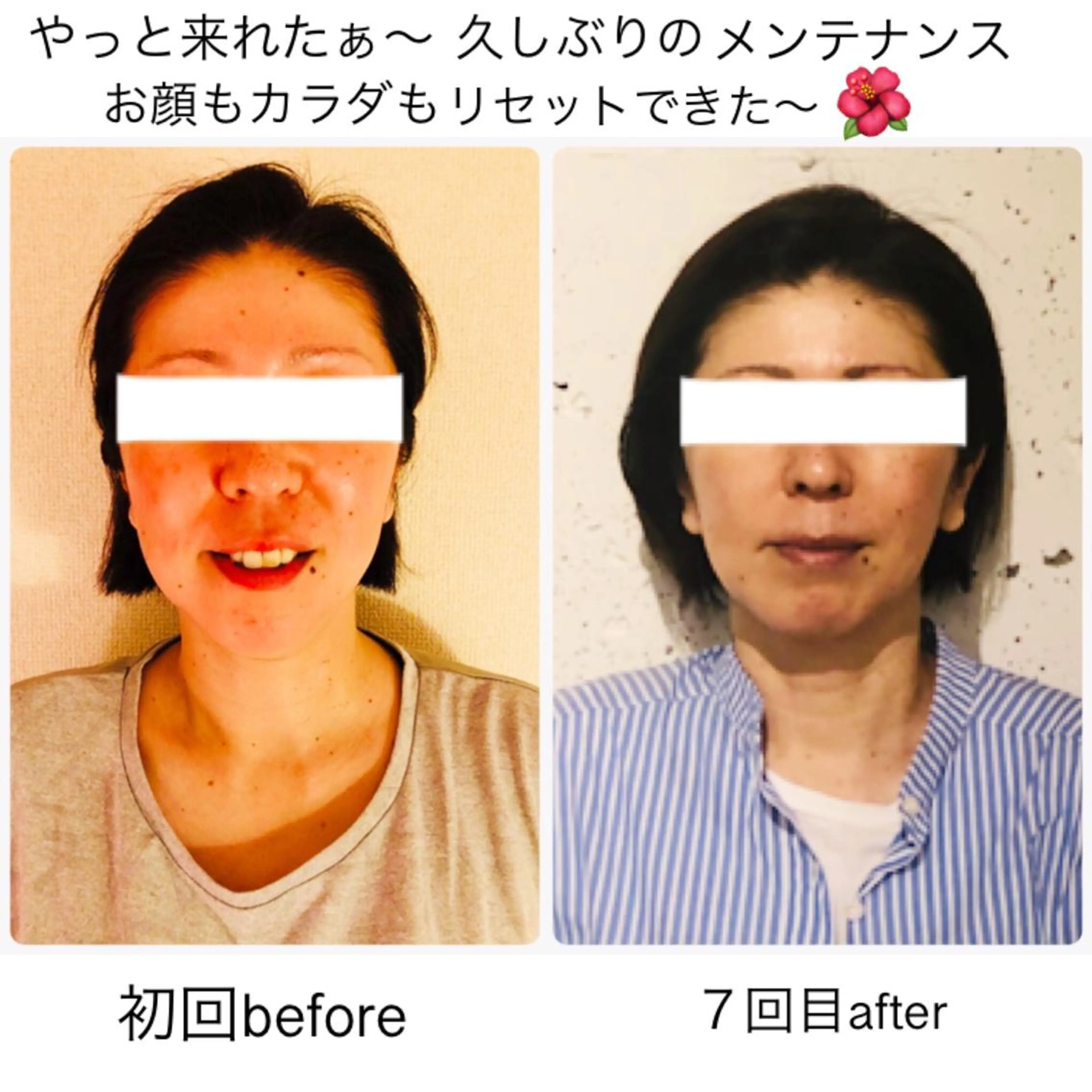 ミディアム カラー マツエク・マツパ 小顔矯正専門サロンジュマリ所属・町田 淳子のエステ・リラクイメージ