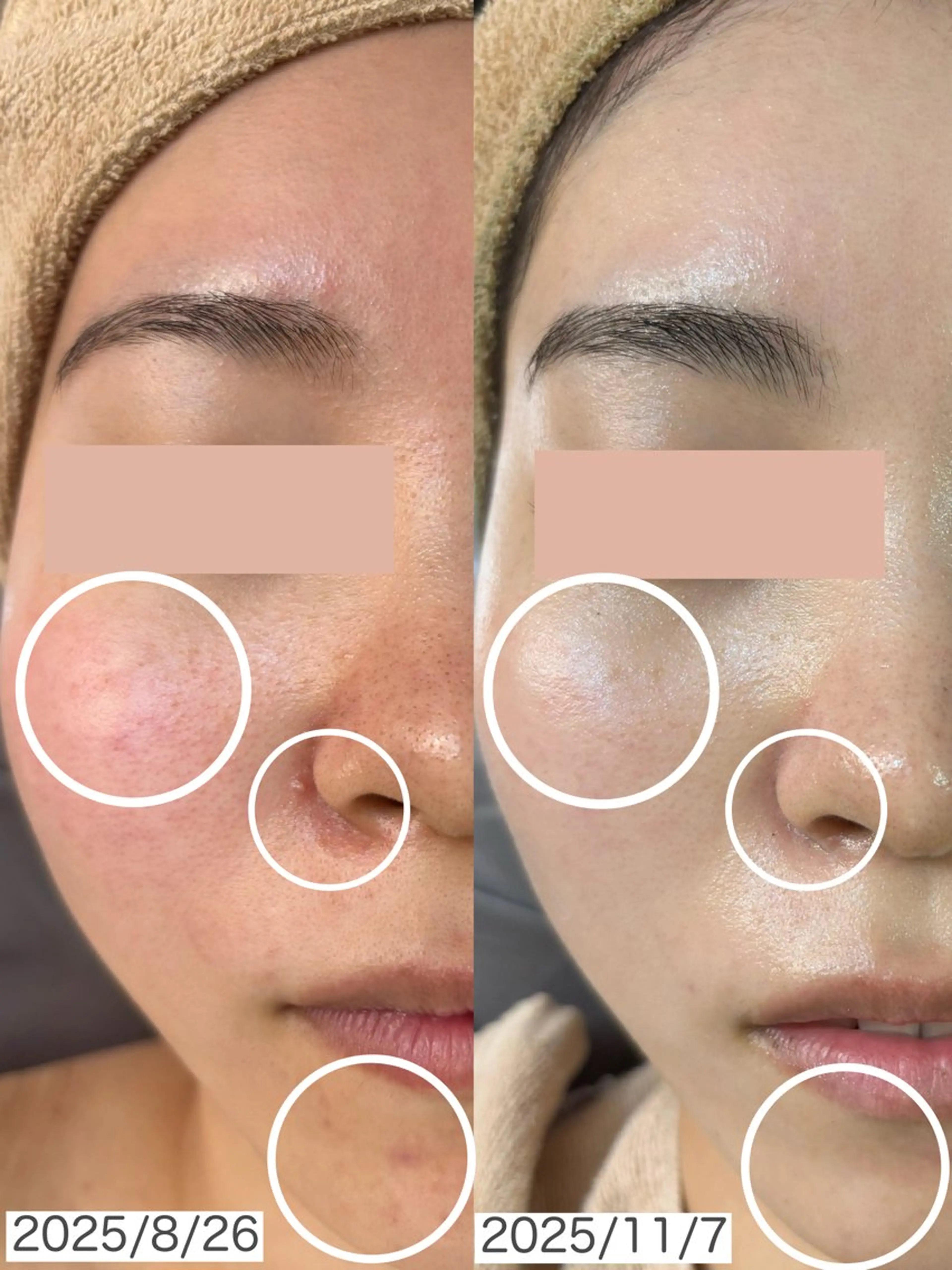 エステ WHITE AQUA 北千住店のエステ・リラクイメージ