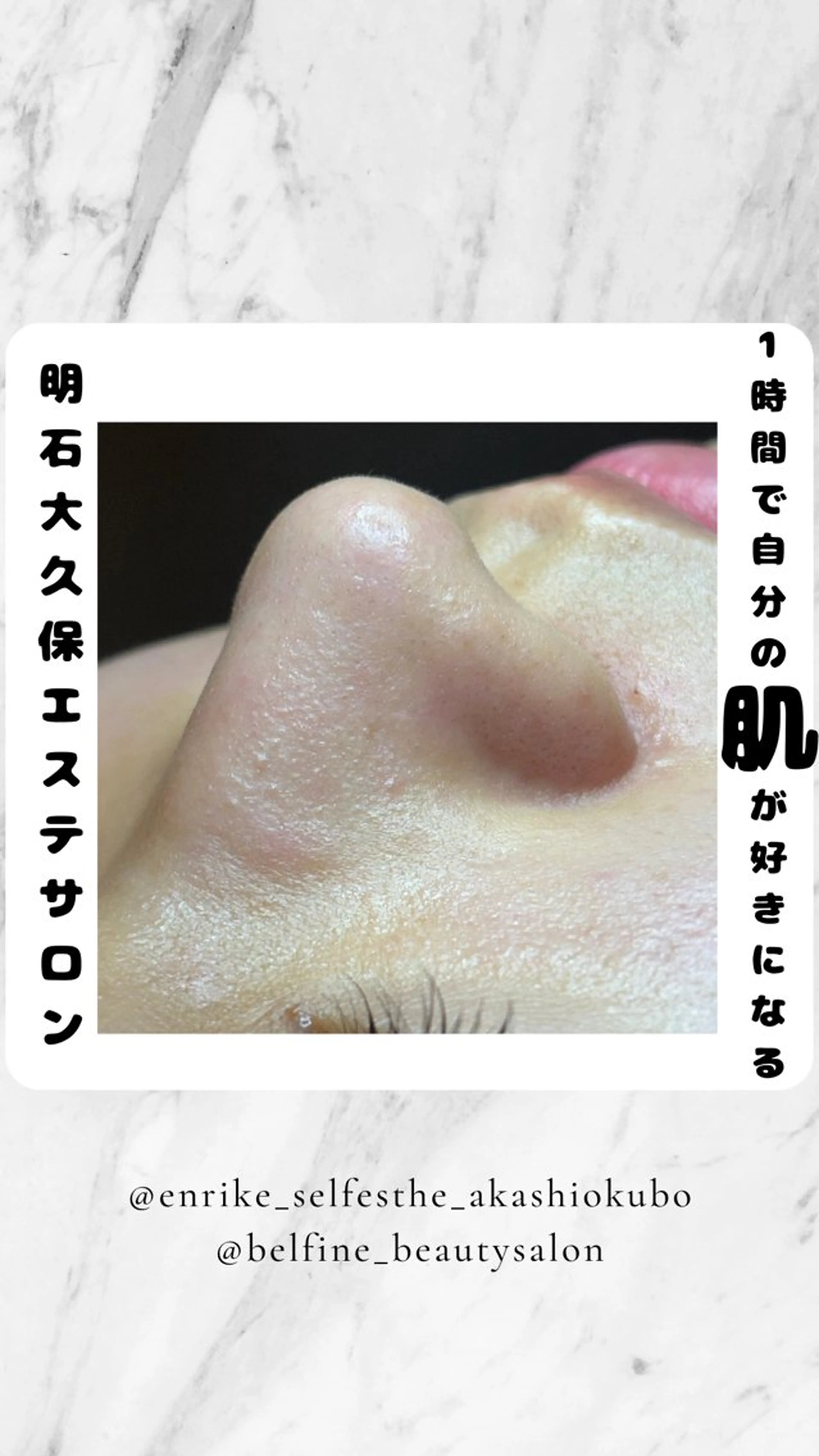 エステ リラク セルフエステエンリケ明石大久保店所属・夕希リンパ&痩身& 脱毛&毛穴ケアのエステ・リラクイメージ
