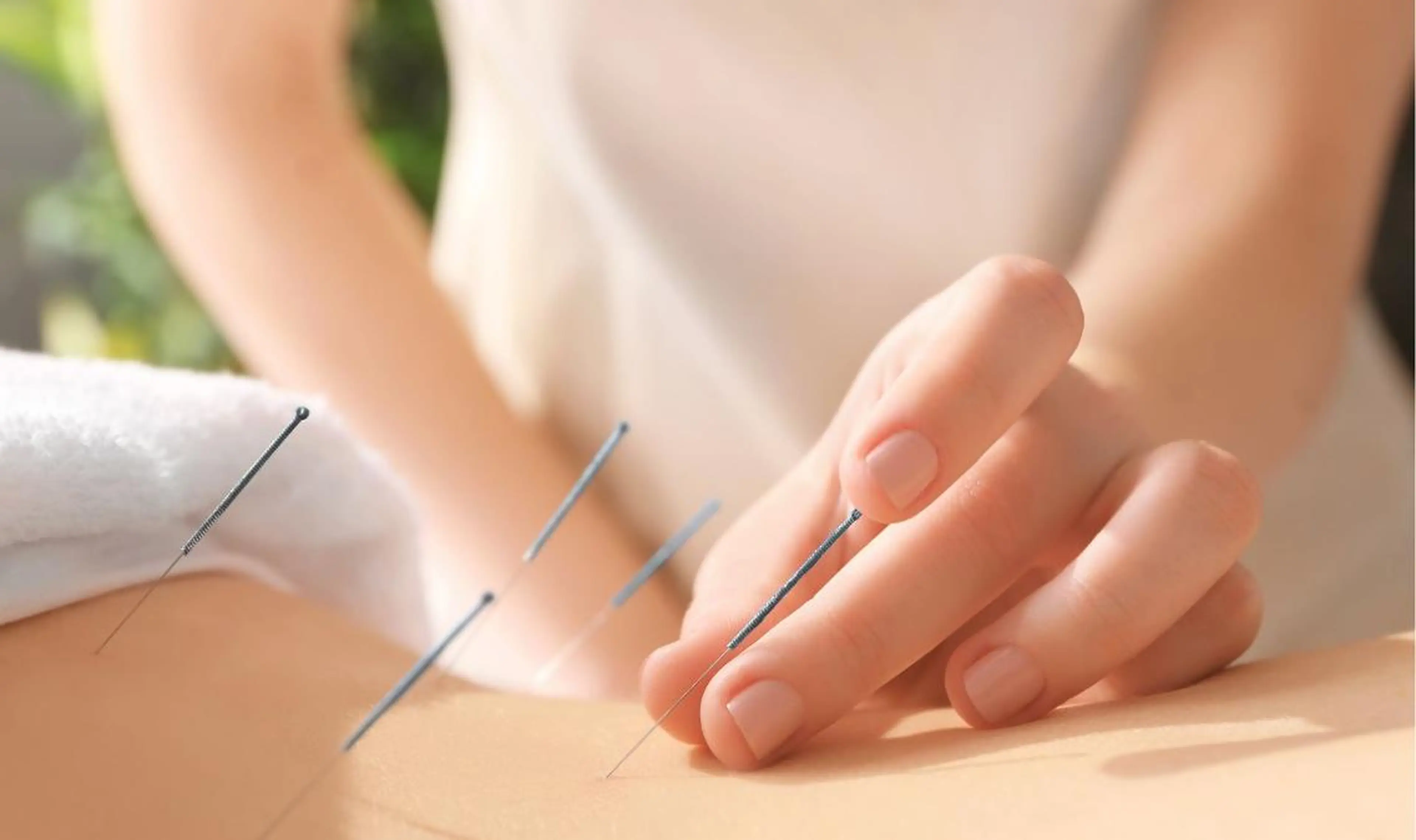 未病にお悩みの方へ 未病鍼灸コースの写真