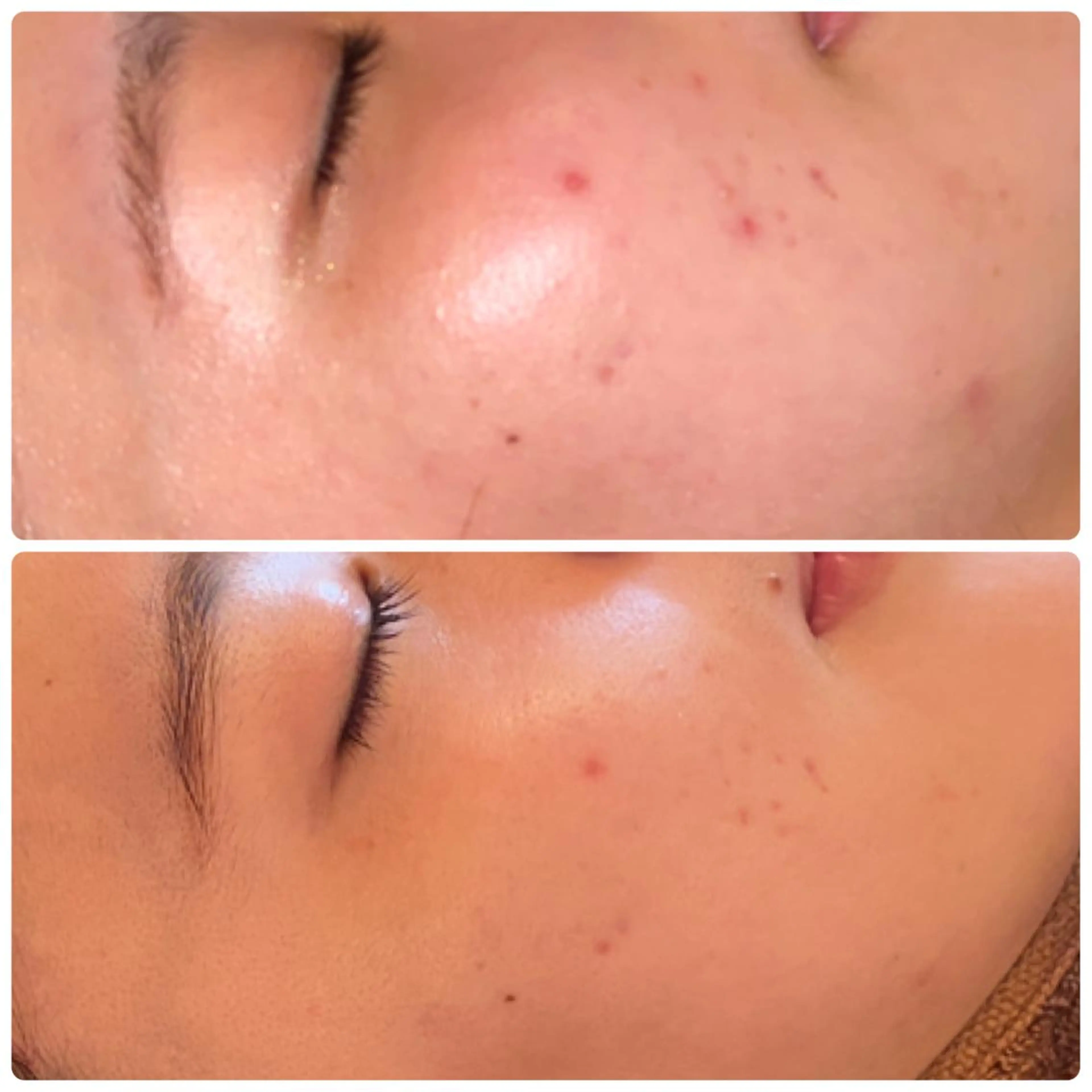 FLEUR大阪・整体 ・ハイフ・痩身・小顔のエステ・リラクイメージ