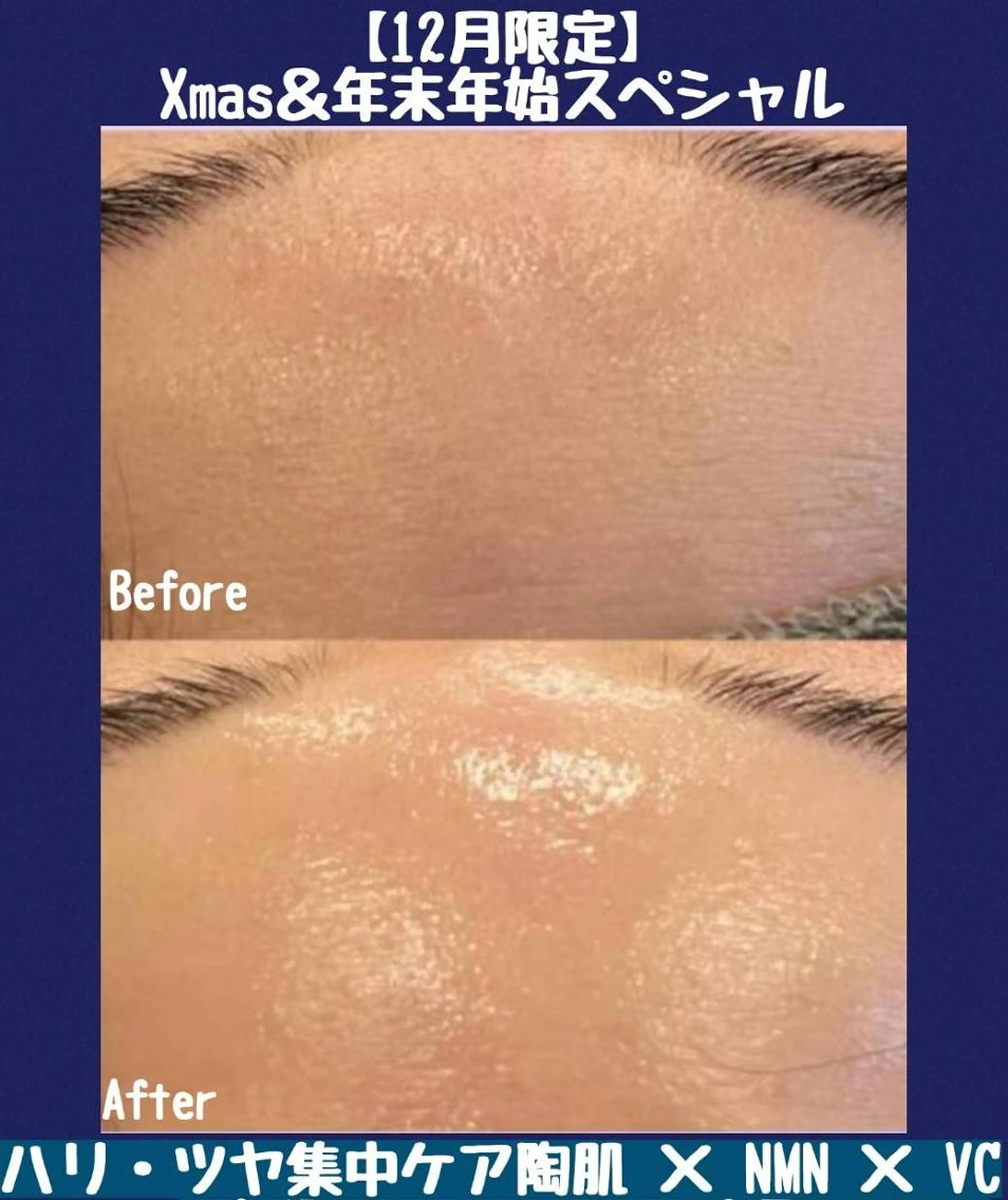 【Xmas&年末年始限定】最高峰NMN×高濃度VCF!ハリ・ツヤ集中剥けないハーブの写真