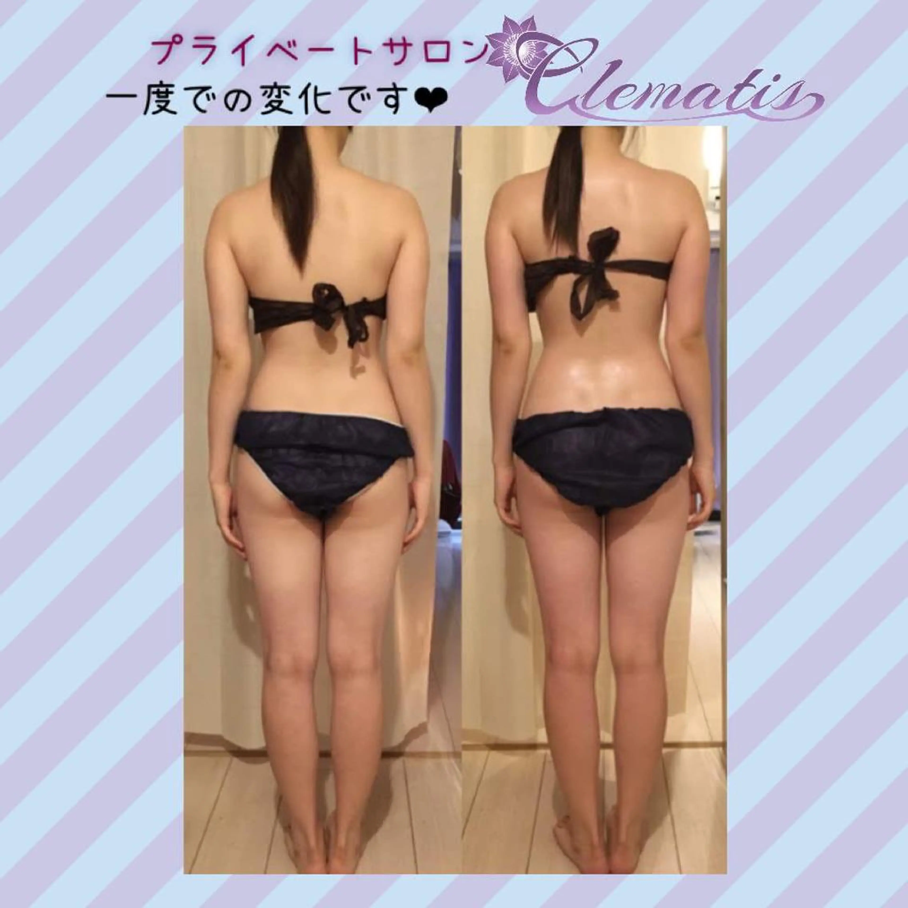 ショート カラー パーマ ヘアアレンジ メンズ キッズ ネイル マツエク・マツパ 強圧オールハンド痩身&黄土よもぎ蒸しプライベートサロンClematis池袋所属・強圧オールハンド痩身 片野のエステ・リラクイメージ