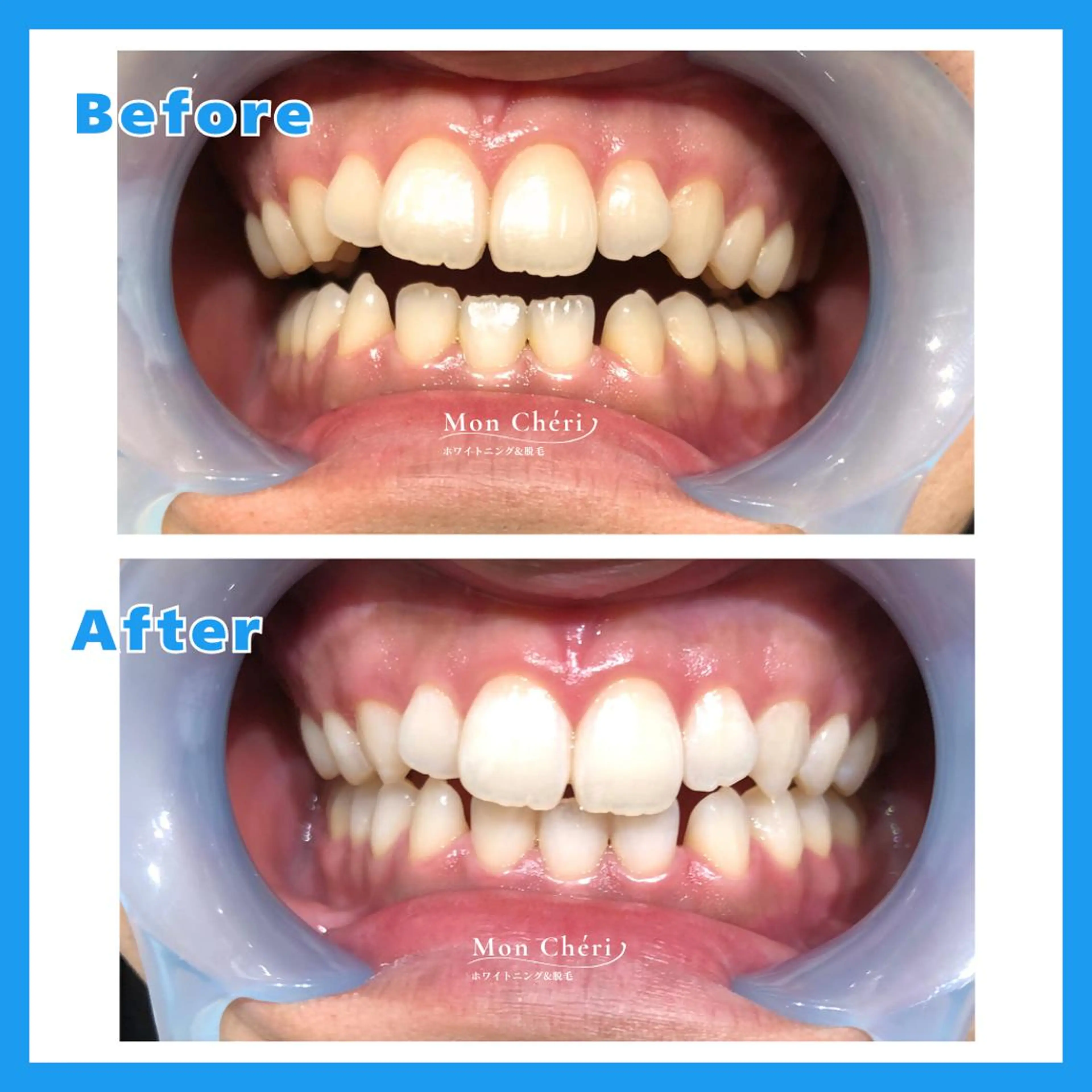 エステ Mon Cheri 広島店のエステ・リラクイメージ