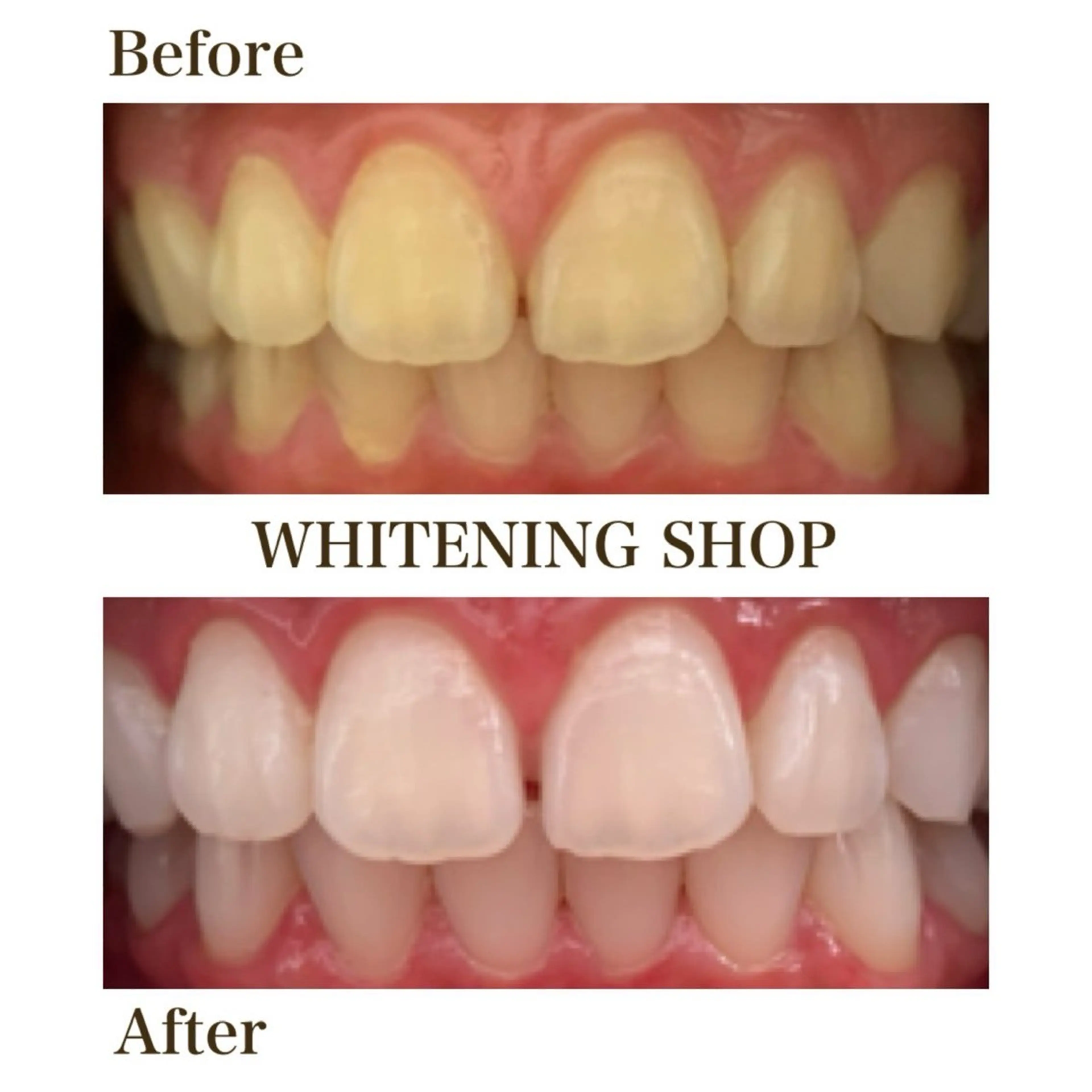 その他 セルフホワイトニングショップ静岡葵区店所属・もえか静岡葵区店ホ ワイトニングショップのその他イメージ