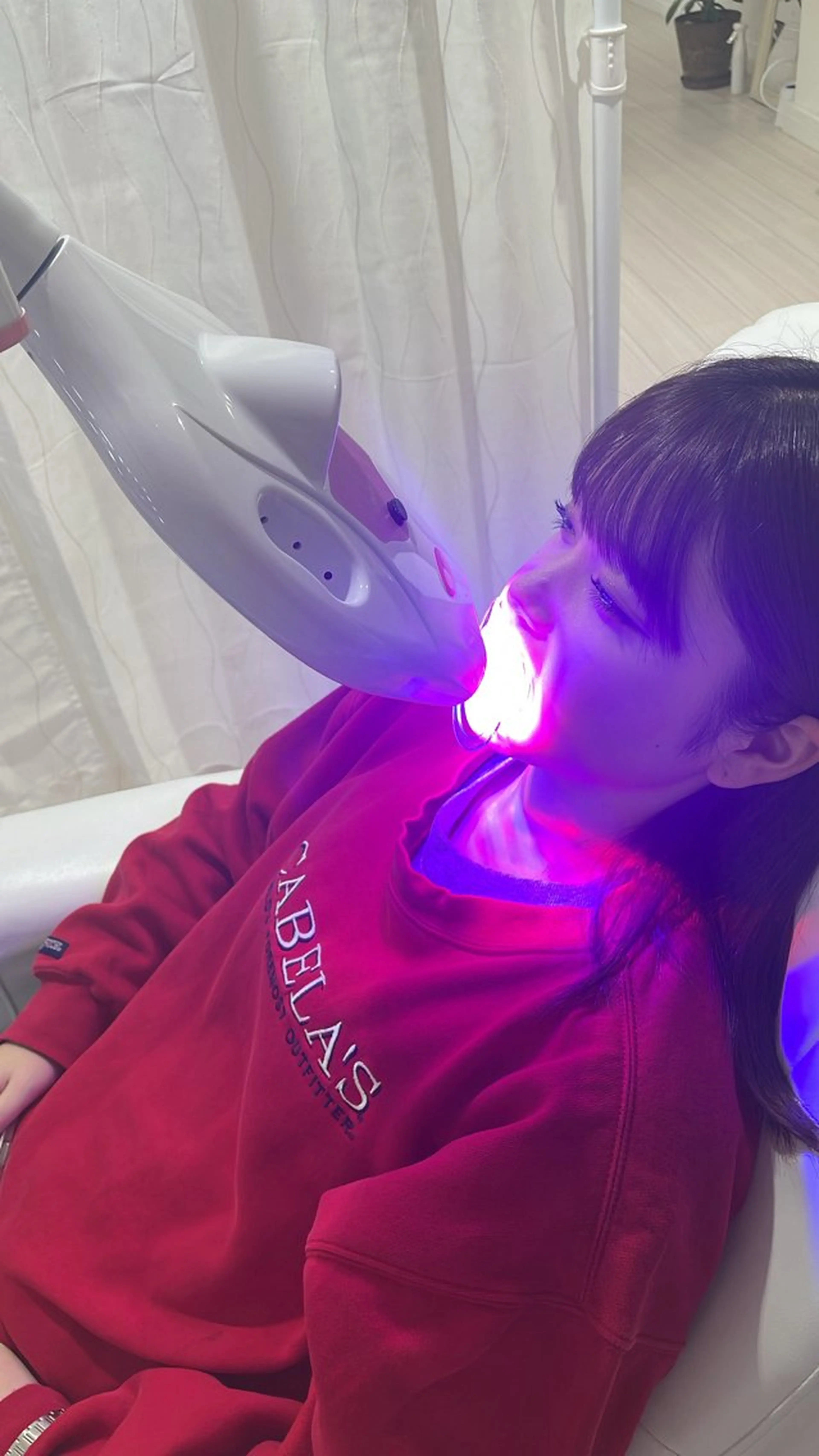 【学割U24】セルフホワイトニング（9分×2セット）1回¥500の写真