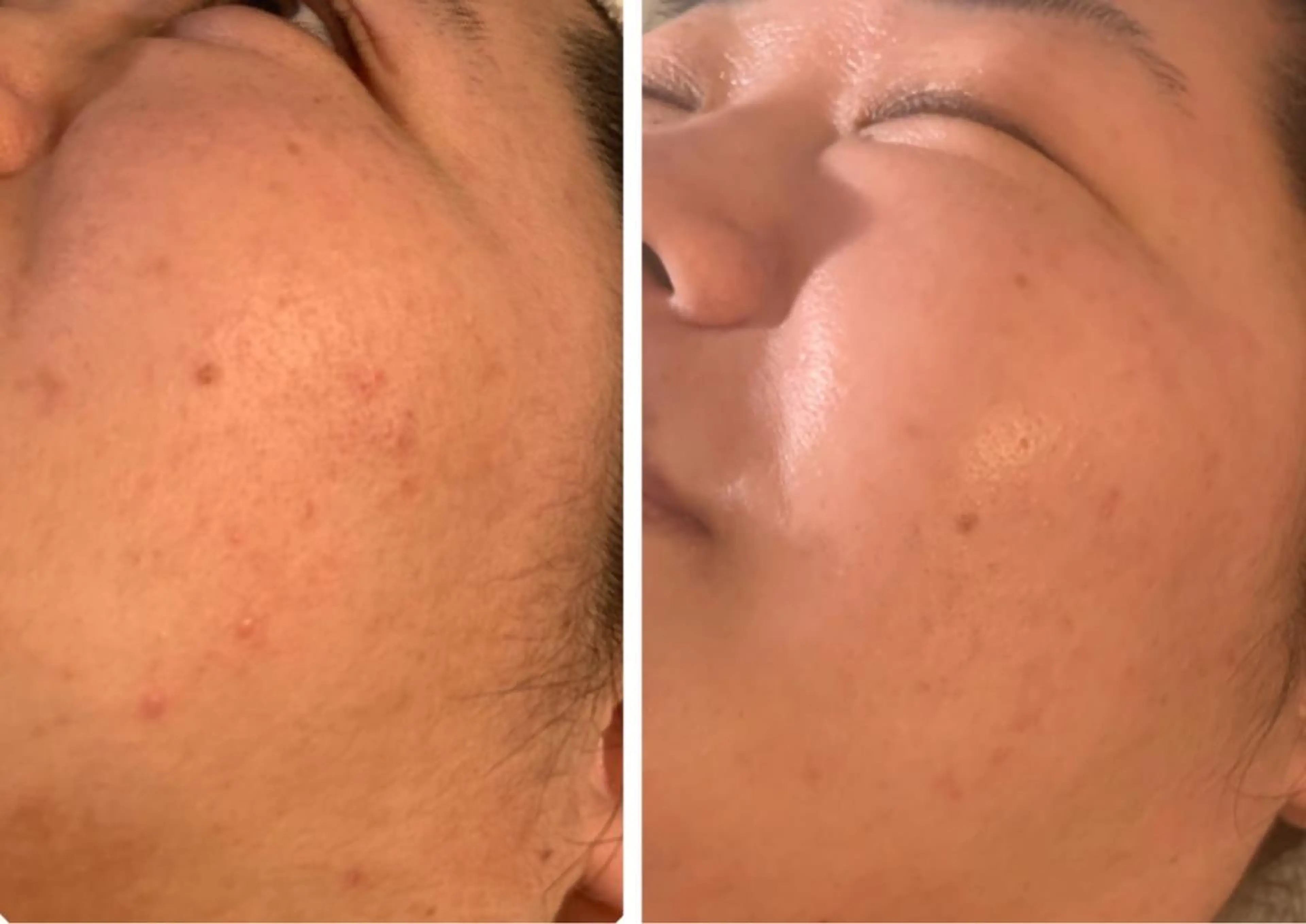 esty hitomiのエステ・リラクイメージ