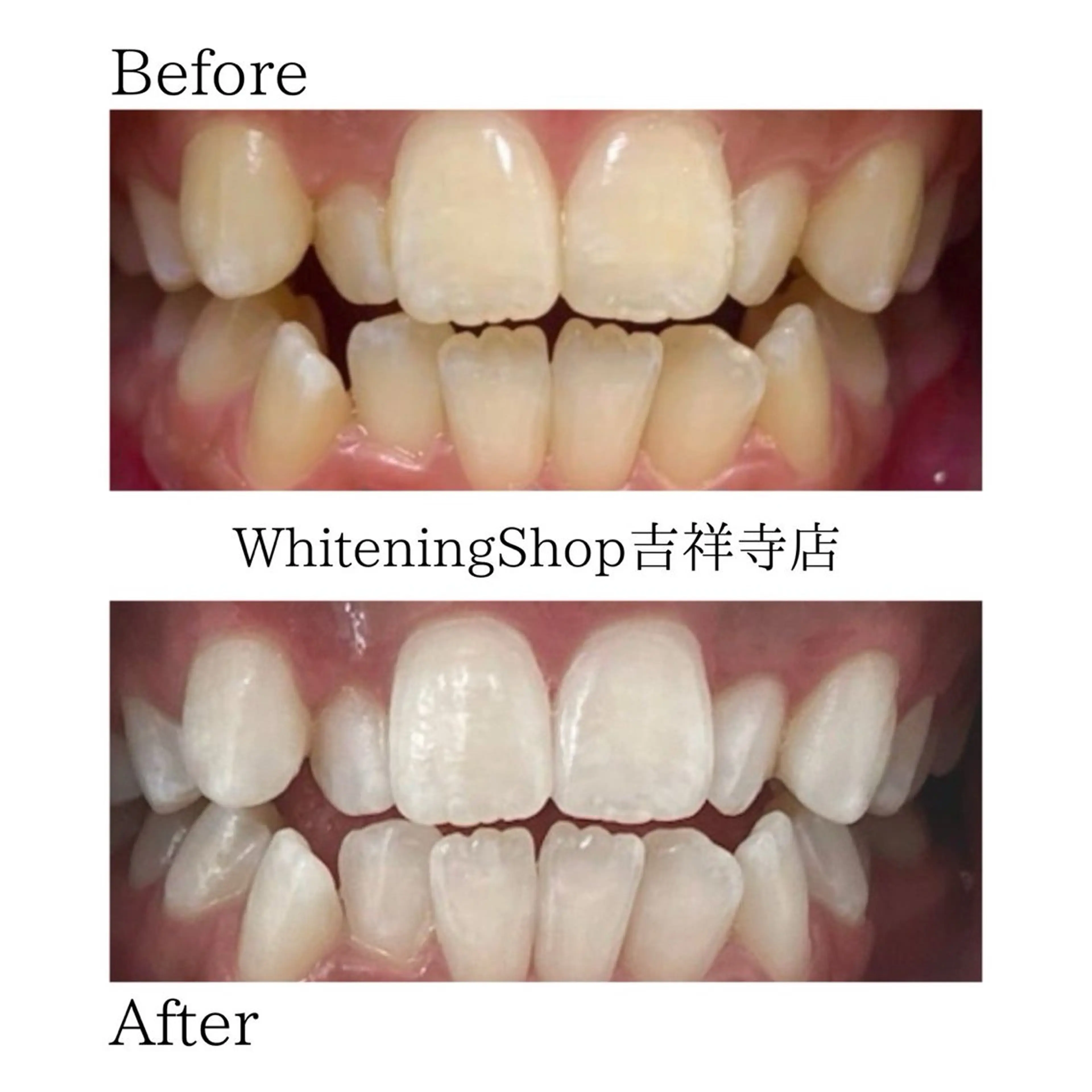 エステ リラク ホワイトニング ショップ吉祥寺店のエステ・リラクイメージ