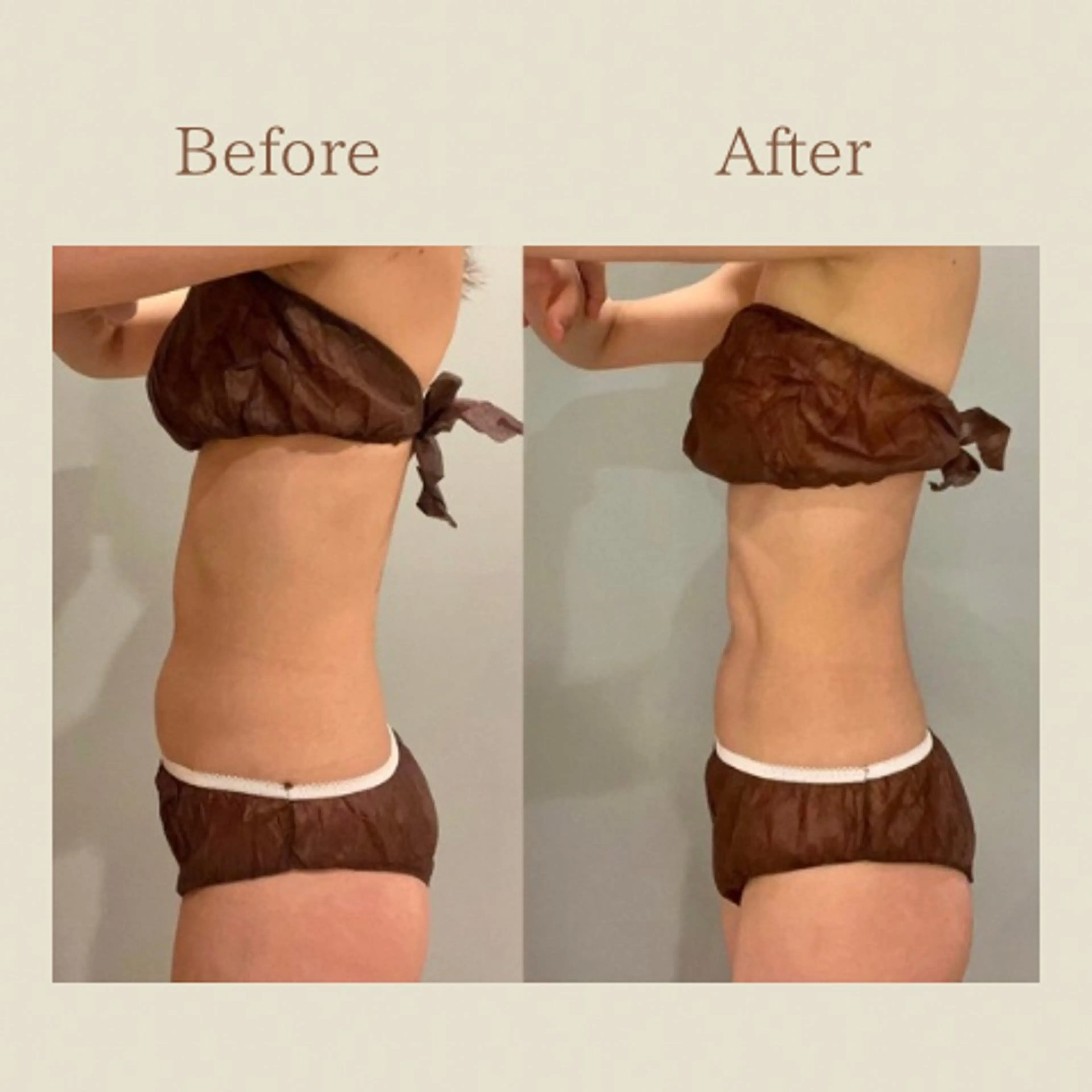 お腹痩せエステ Flat BELLY 恵比寿所属・【腸もみ/脂肪冷却】 お腹エステ/恵比寿のエステ・リラクイメージ