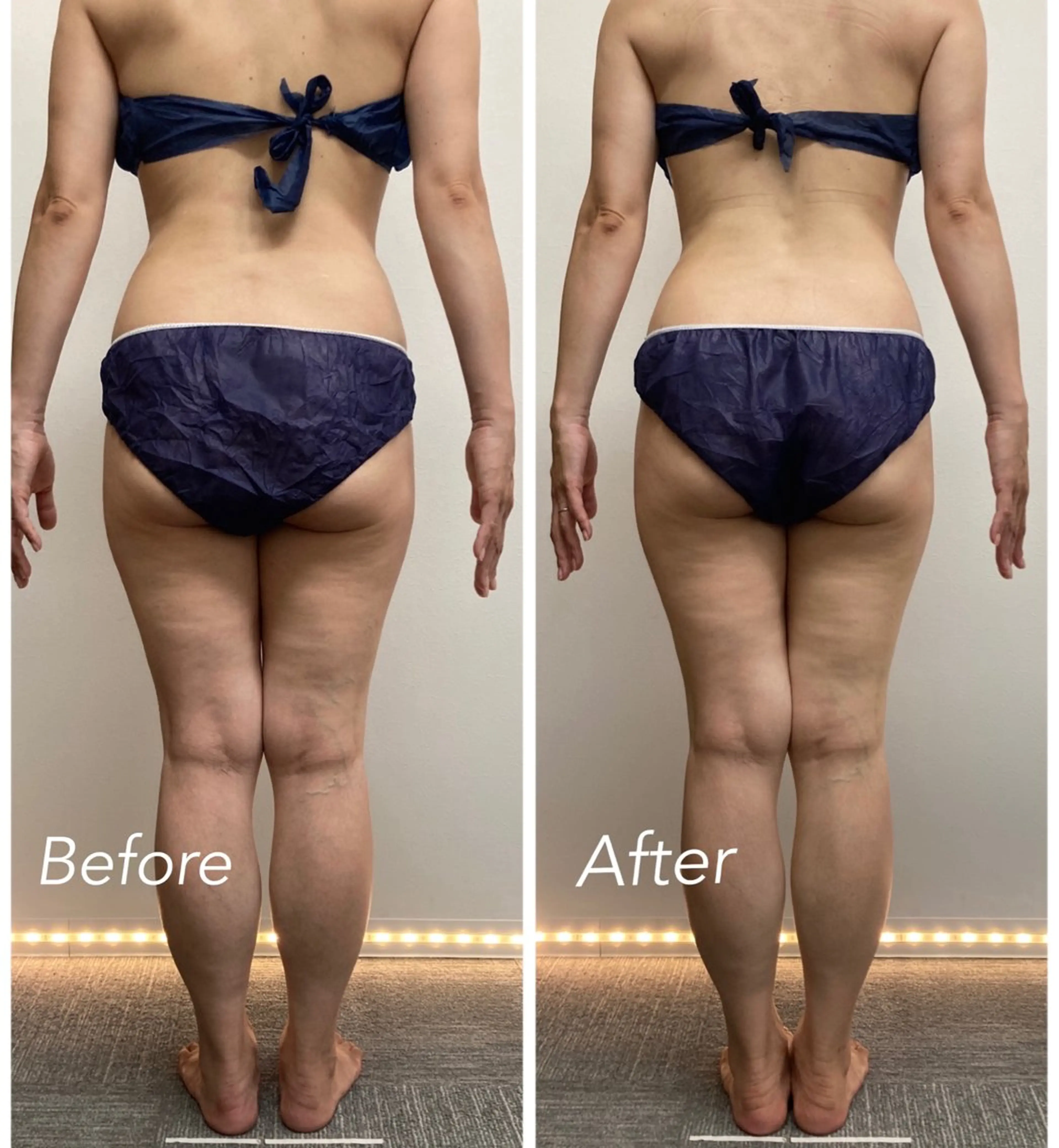 エステ リラク Natalieナタリー所属・Natalie Sayuriのエステ・リラクイメージ