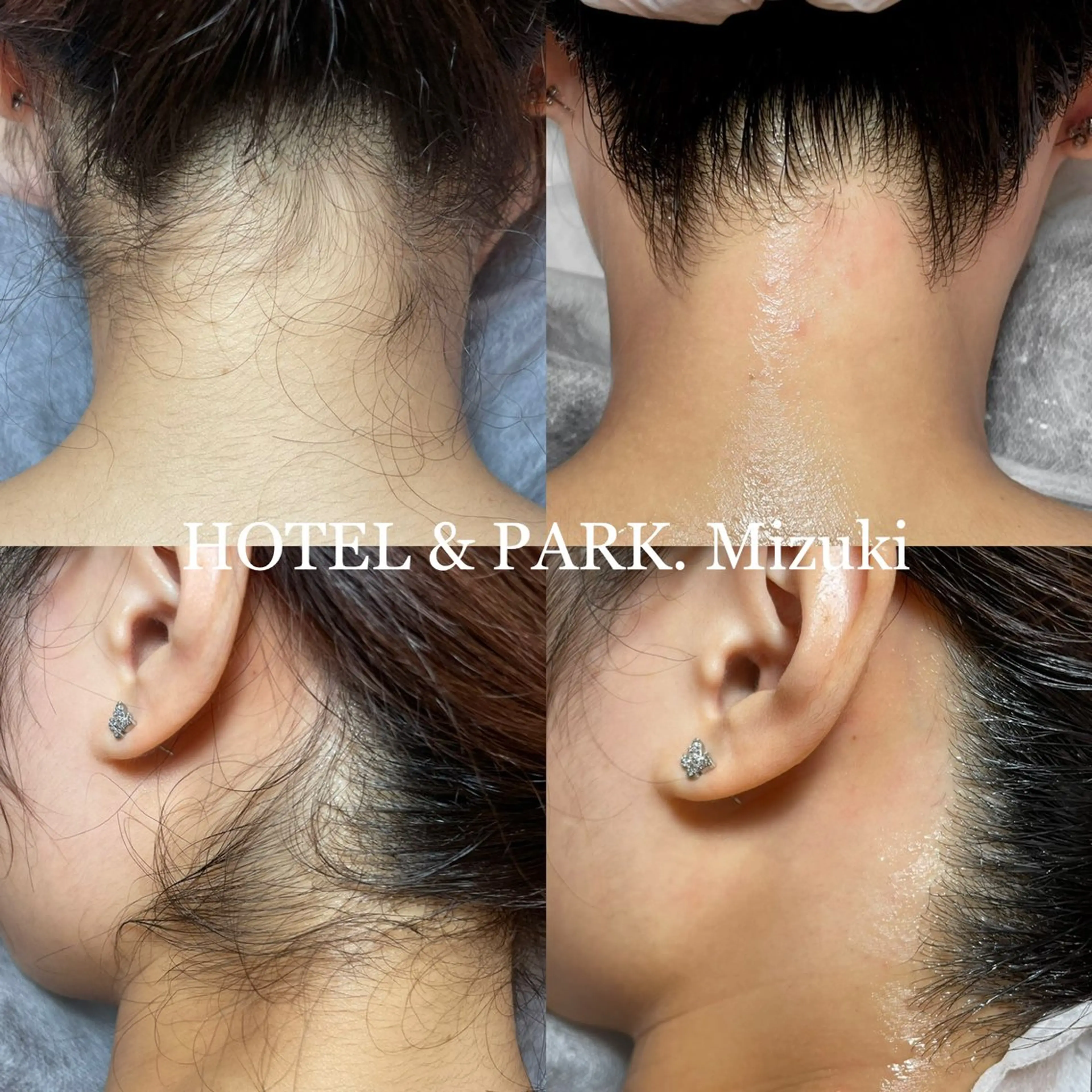 脱毛 HOTEL&PARK . ワックス脱毛のエステ・リラクイメージ