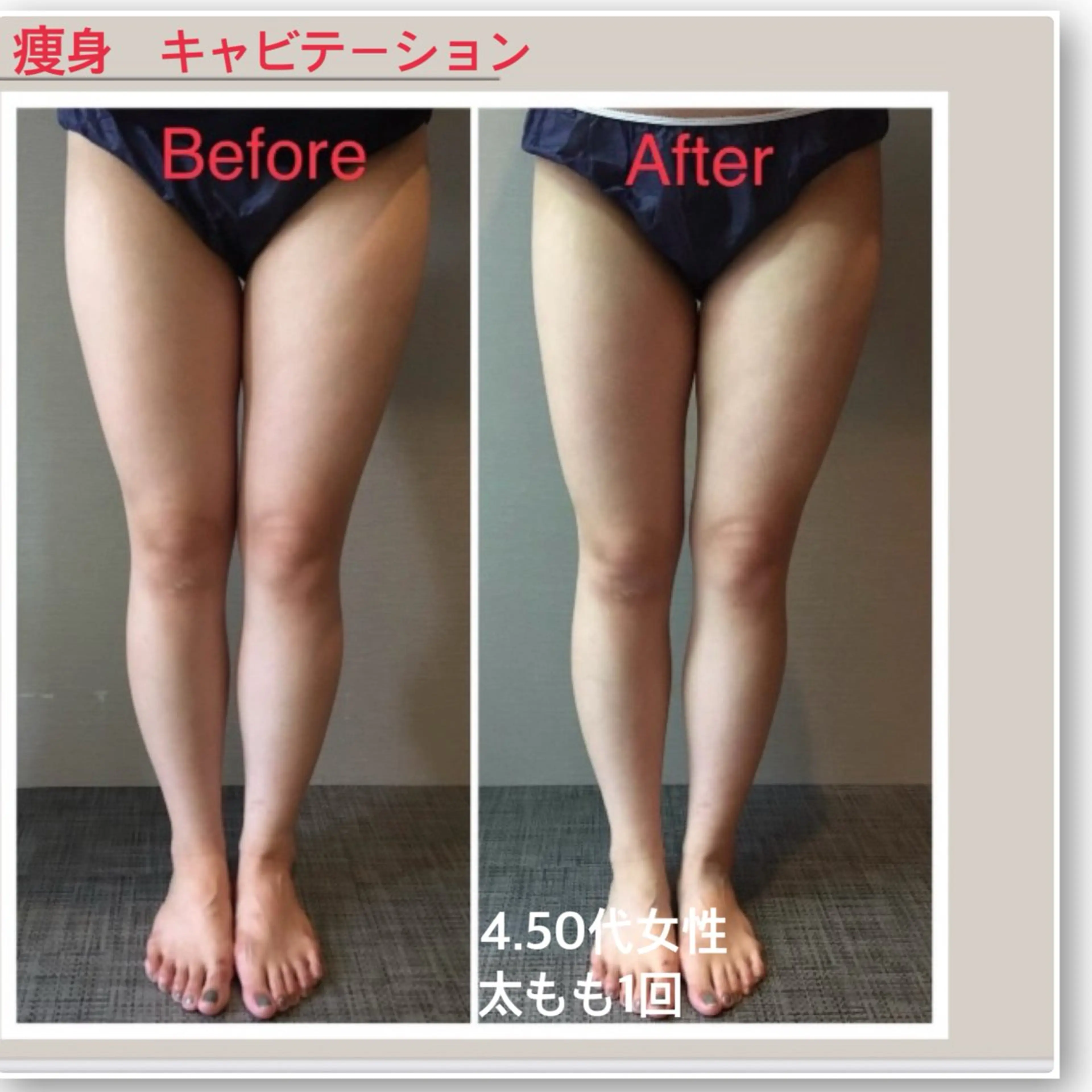 ダイエットしてても体重が落ちにくい方に痩身！体験お試しプラン20分口コミ書いてくれる方のみ✨の写真