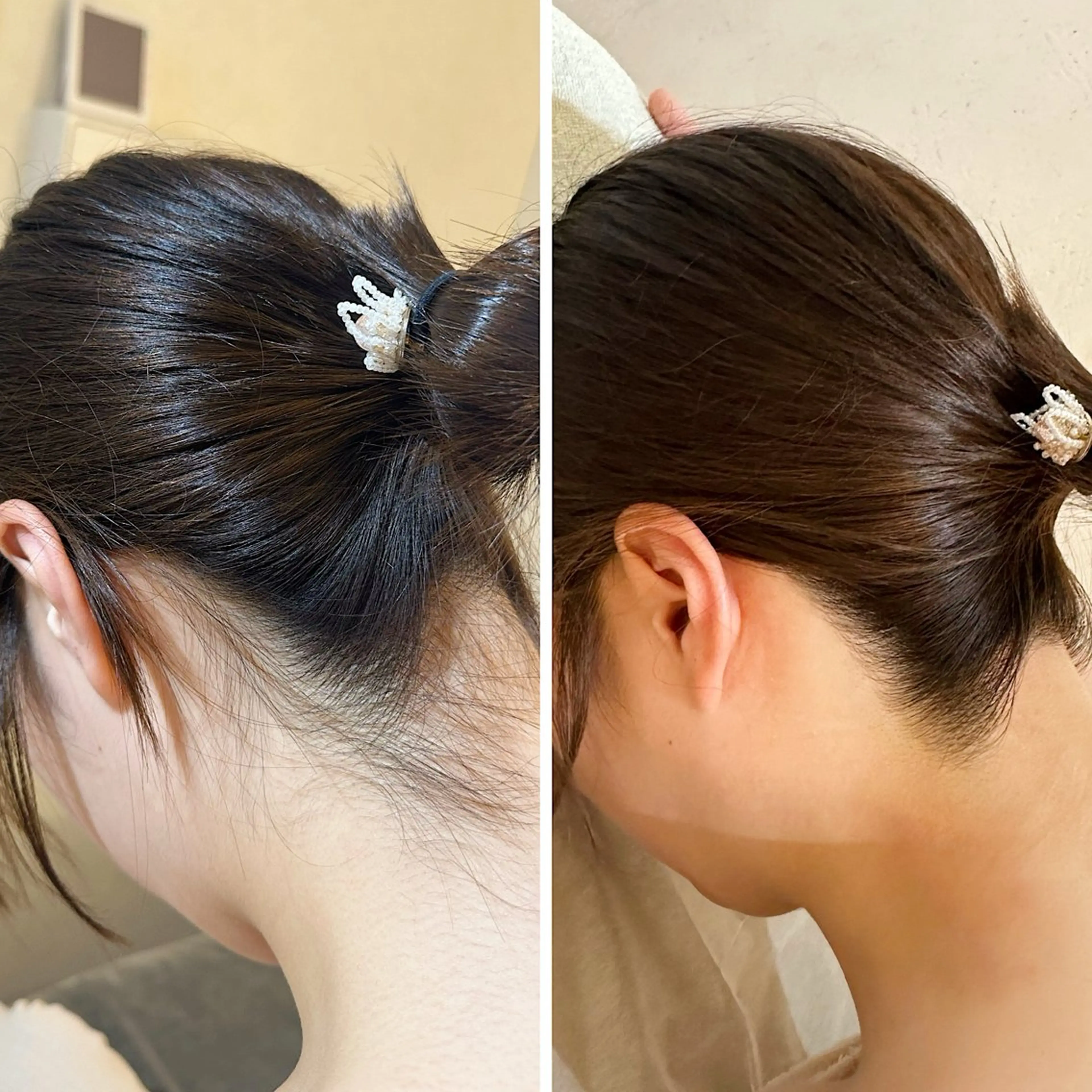 脱毛 うなじ脱毛/美肌脱毛 LABELのエステ・リラクイメージ