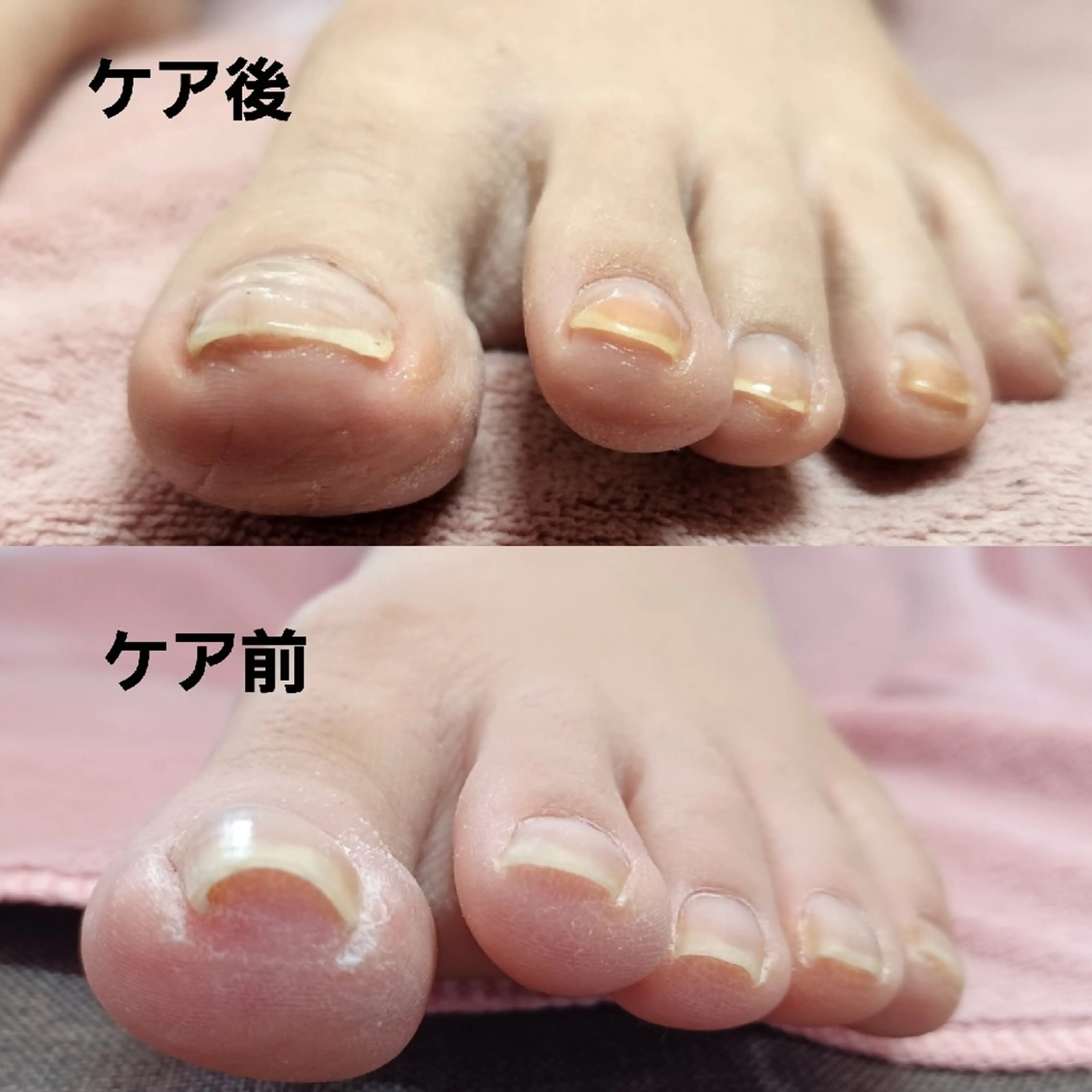 ネイル Micky nail chikushinoのネイルデザイン