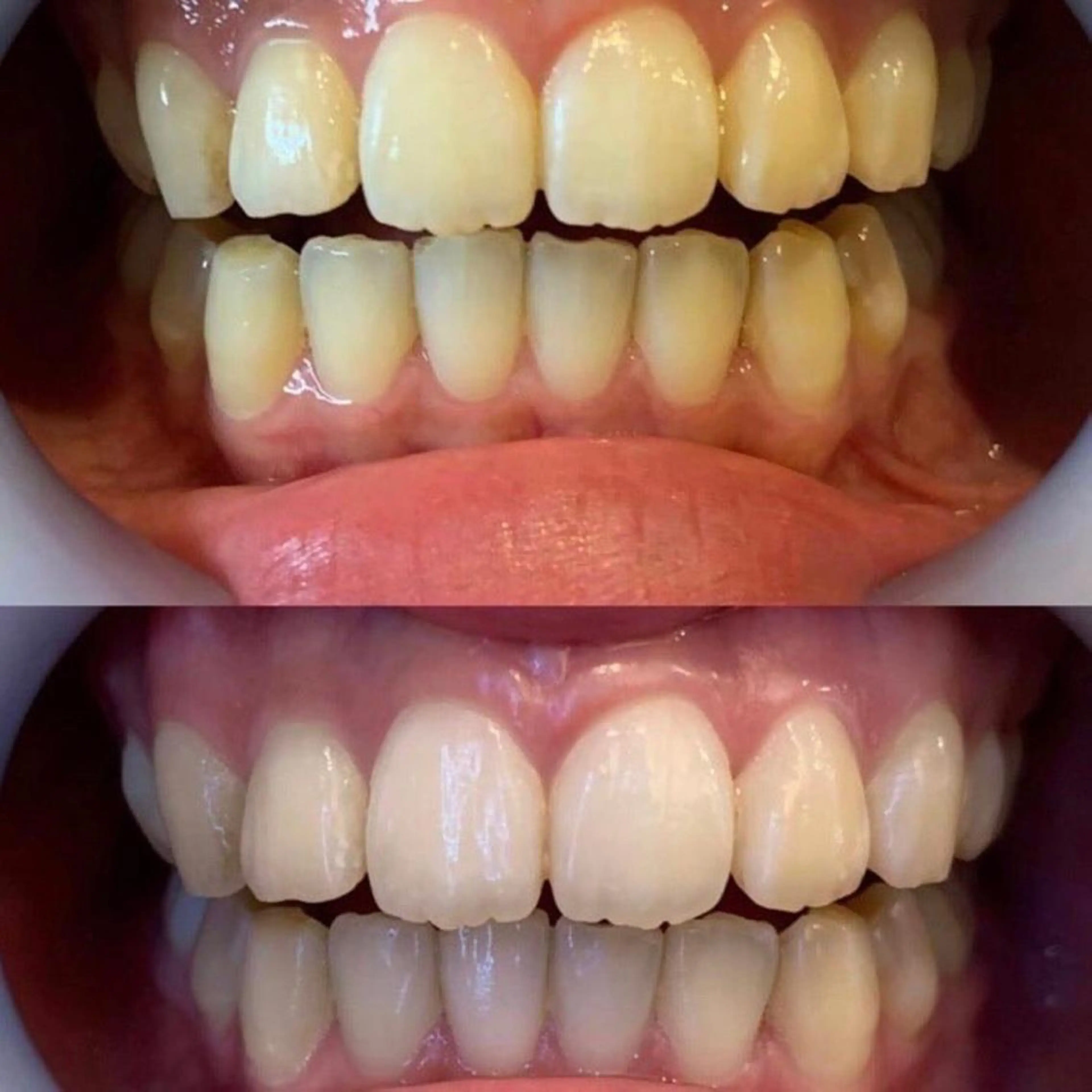 セミロング カラー パーマ ヘアアレンジ ネイル マツエク・マツパ アイブロウ ホワイト LBSホワイトニング 🩵梅田店公式のエステ・リラクイメージ