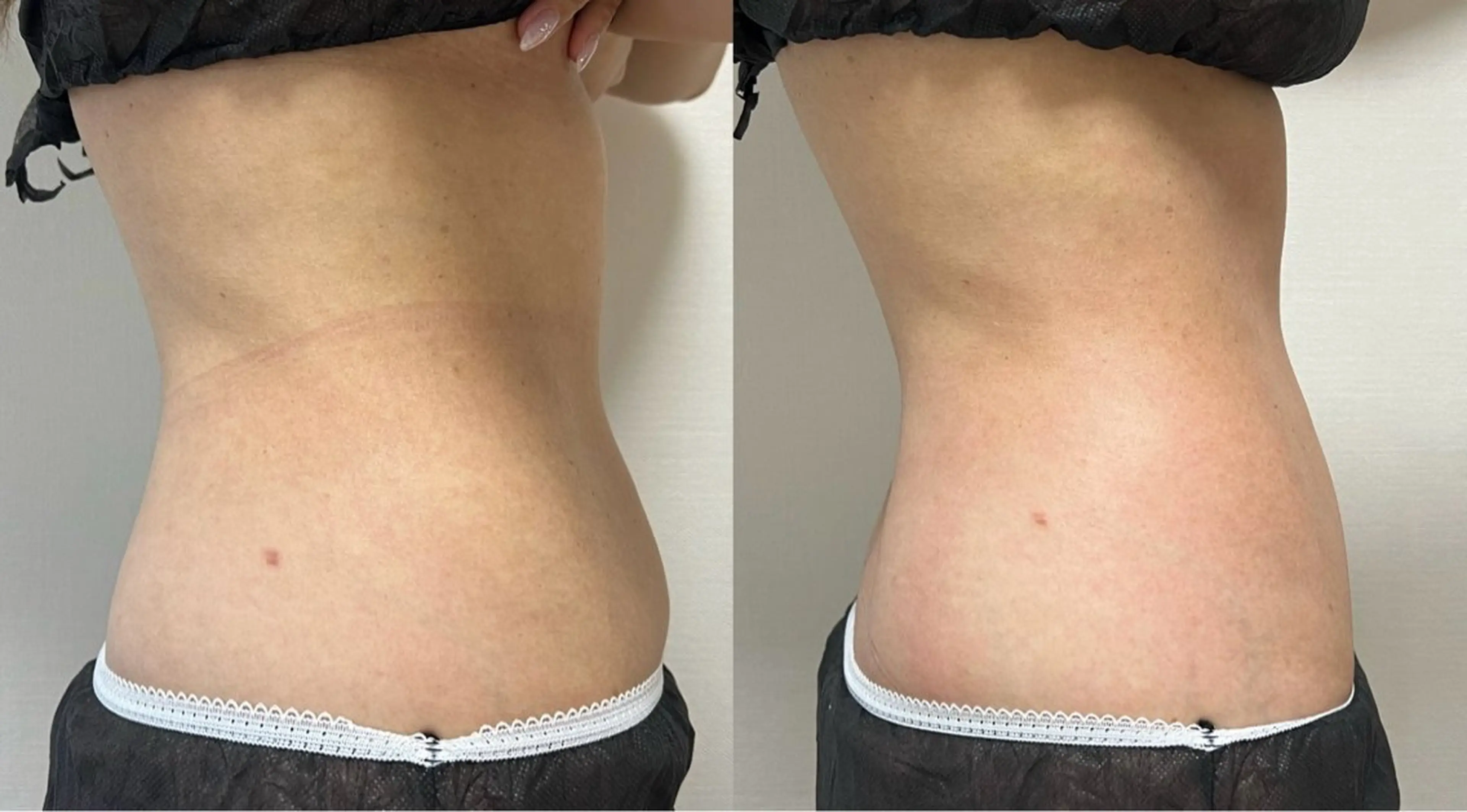 Beauty   Salon  Adiy所属・Adiy ikumiのエステ・リラクイメージ