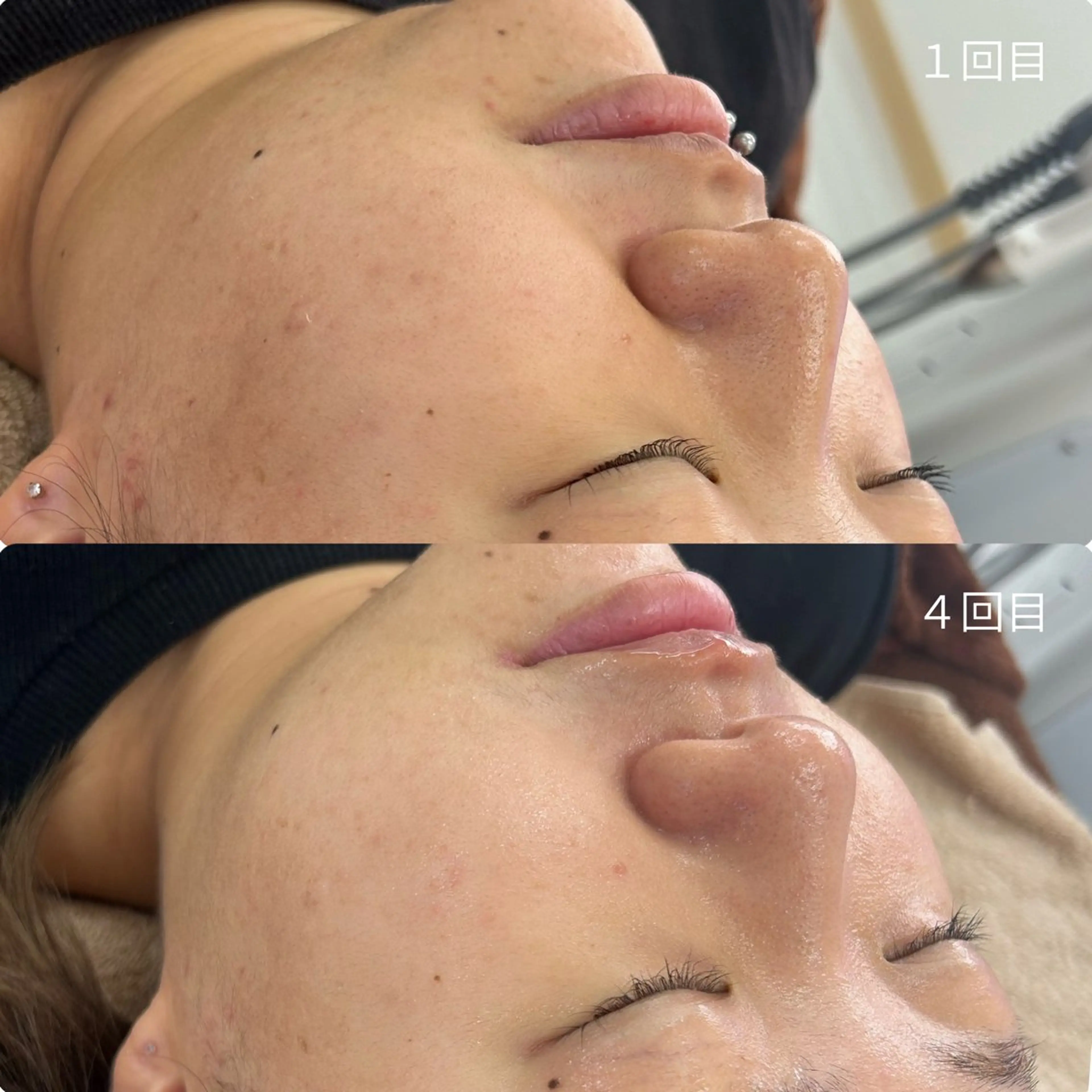 エステ Venus所属・エステサロン Venusのその他イメージ