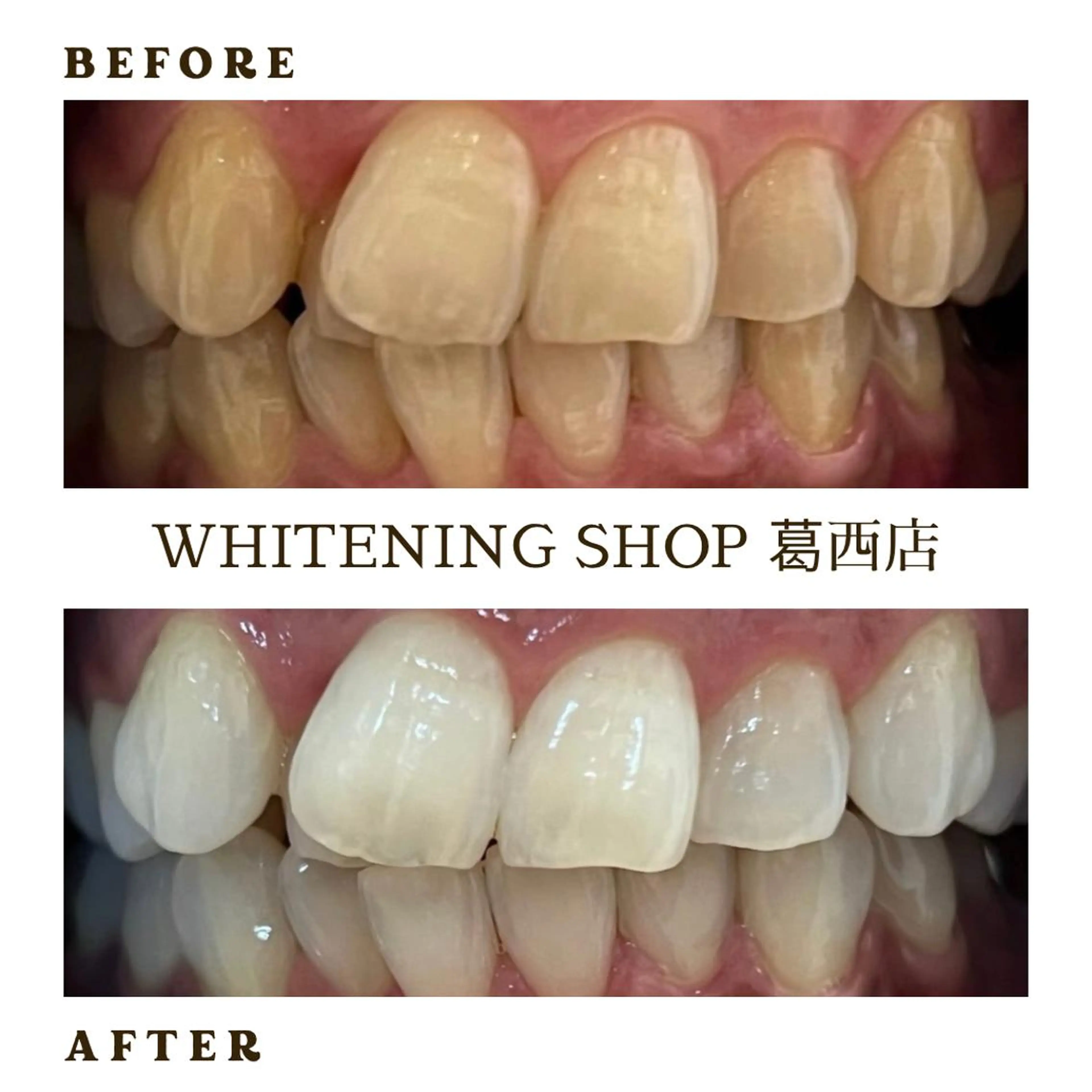 メンズ その他 ホワイトニング ショップ葛西店のその他イメージ