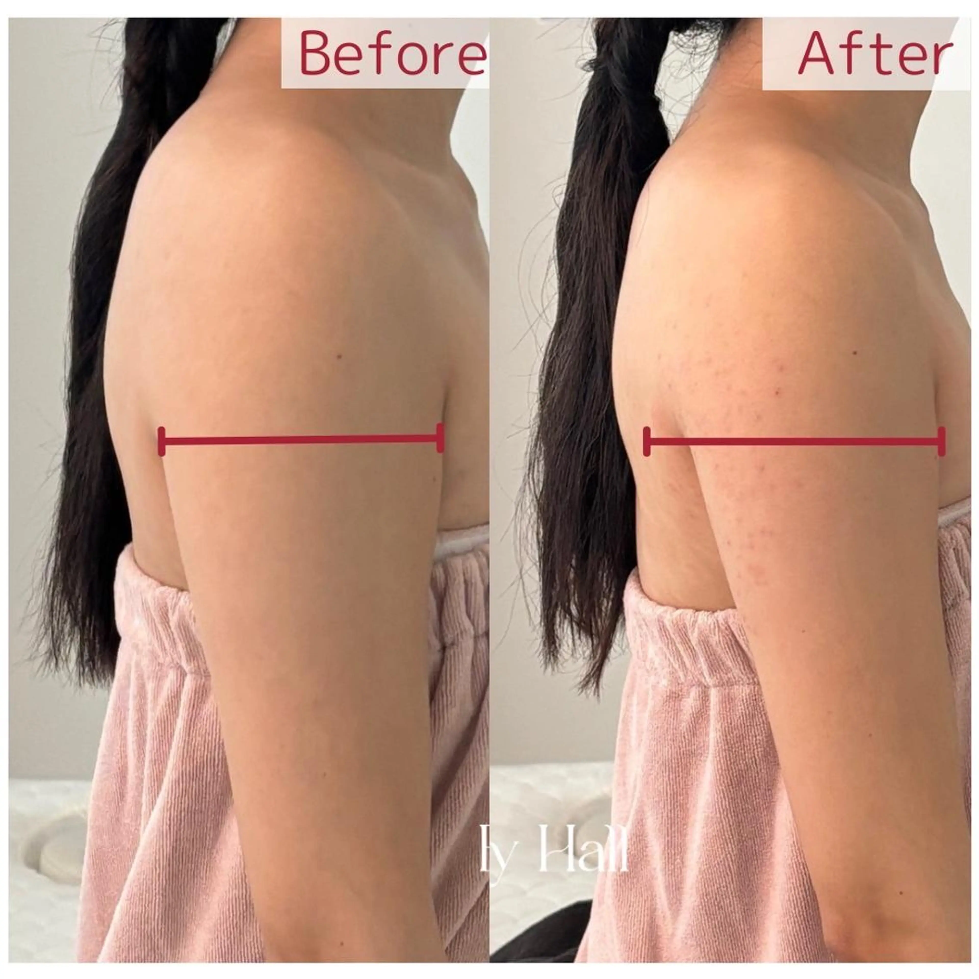 Lien オーナー 山口智嘉のエステ・リラクイメージ