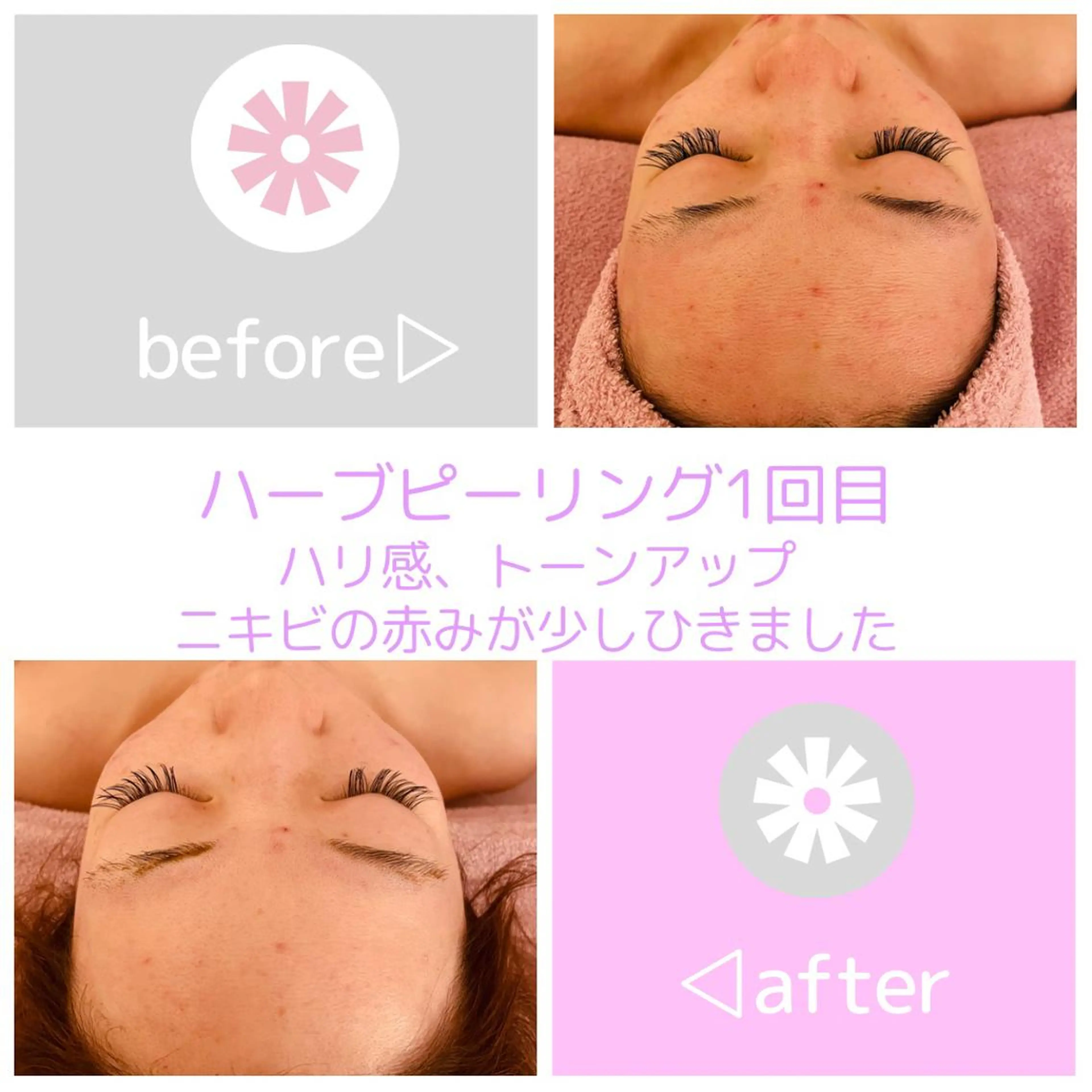 ell 東大阪所属・🎀BiBiハーブ コスパ強美肌サロンのエステ・リラクイメージ