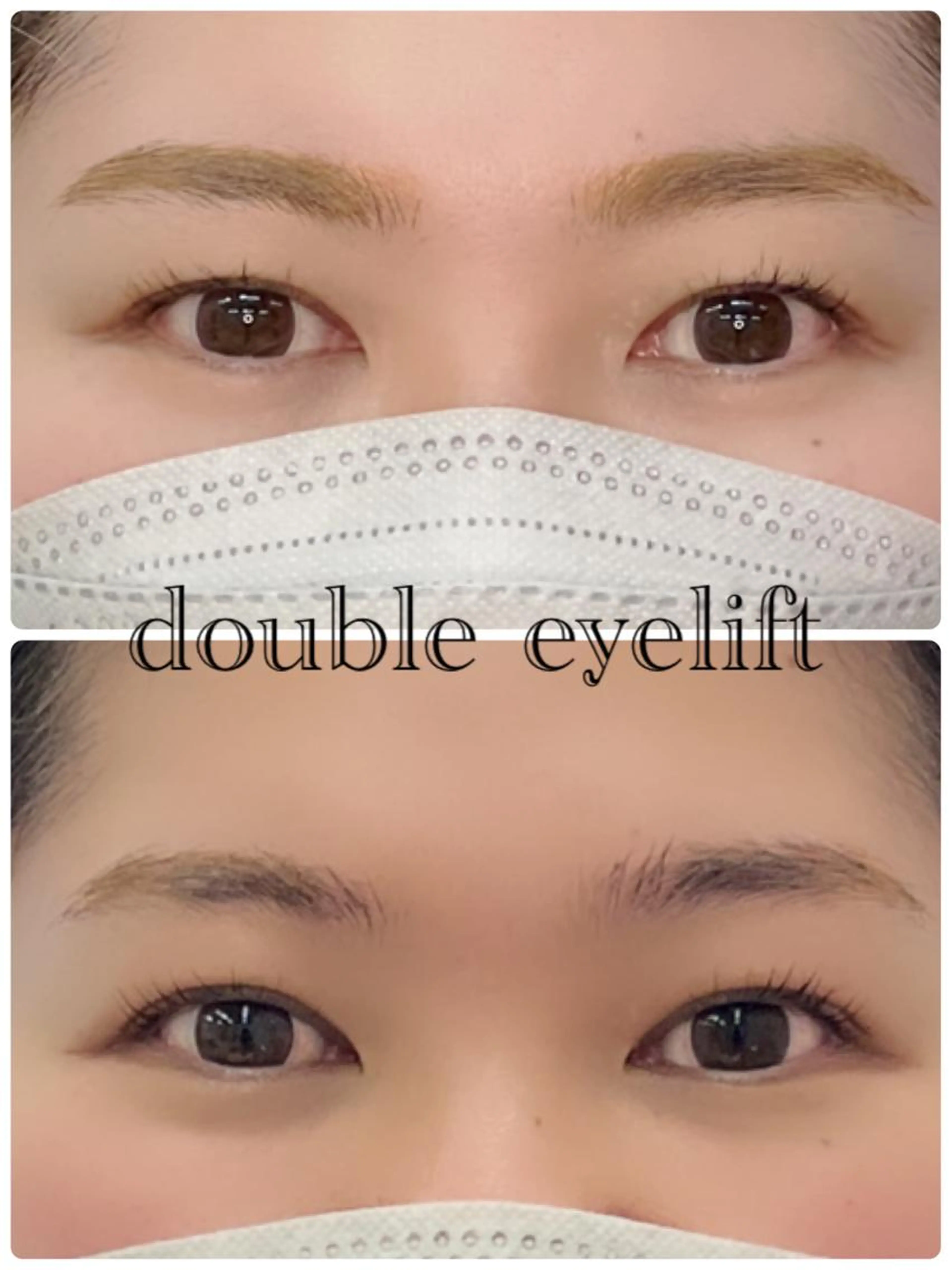 宗像市初✨✳︎ダブルアイリフト✳︎アイストレッチと専用まつ毛パーマで二重が定着しやすくなります🫶🏻の写真