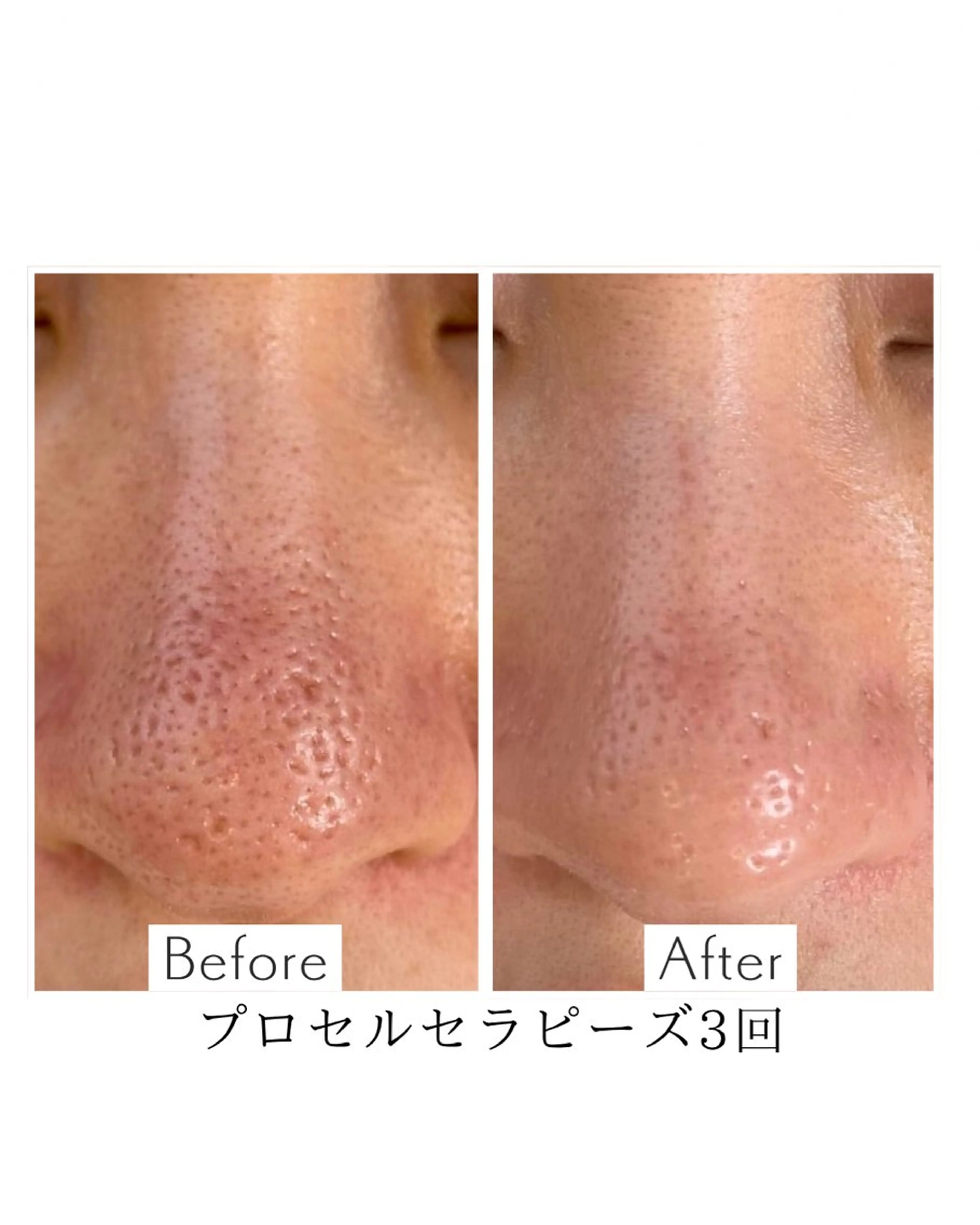 エステ private salon Aola所属・プライベートサロン アオラのネイルデザイン