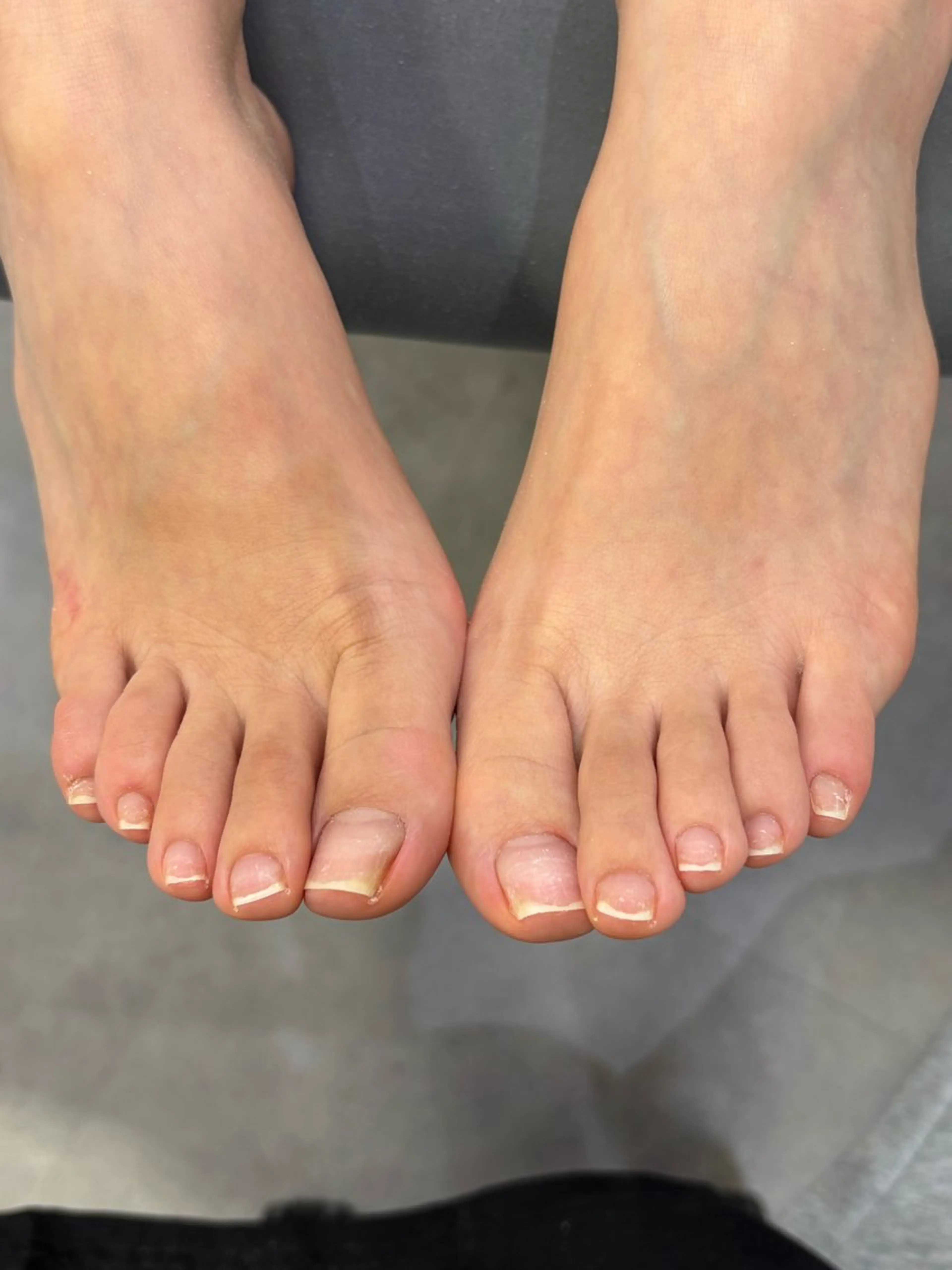 フットオフ（ケア込み）の写真