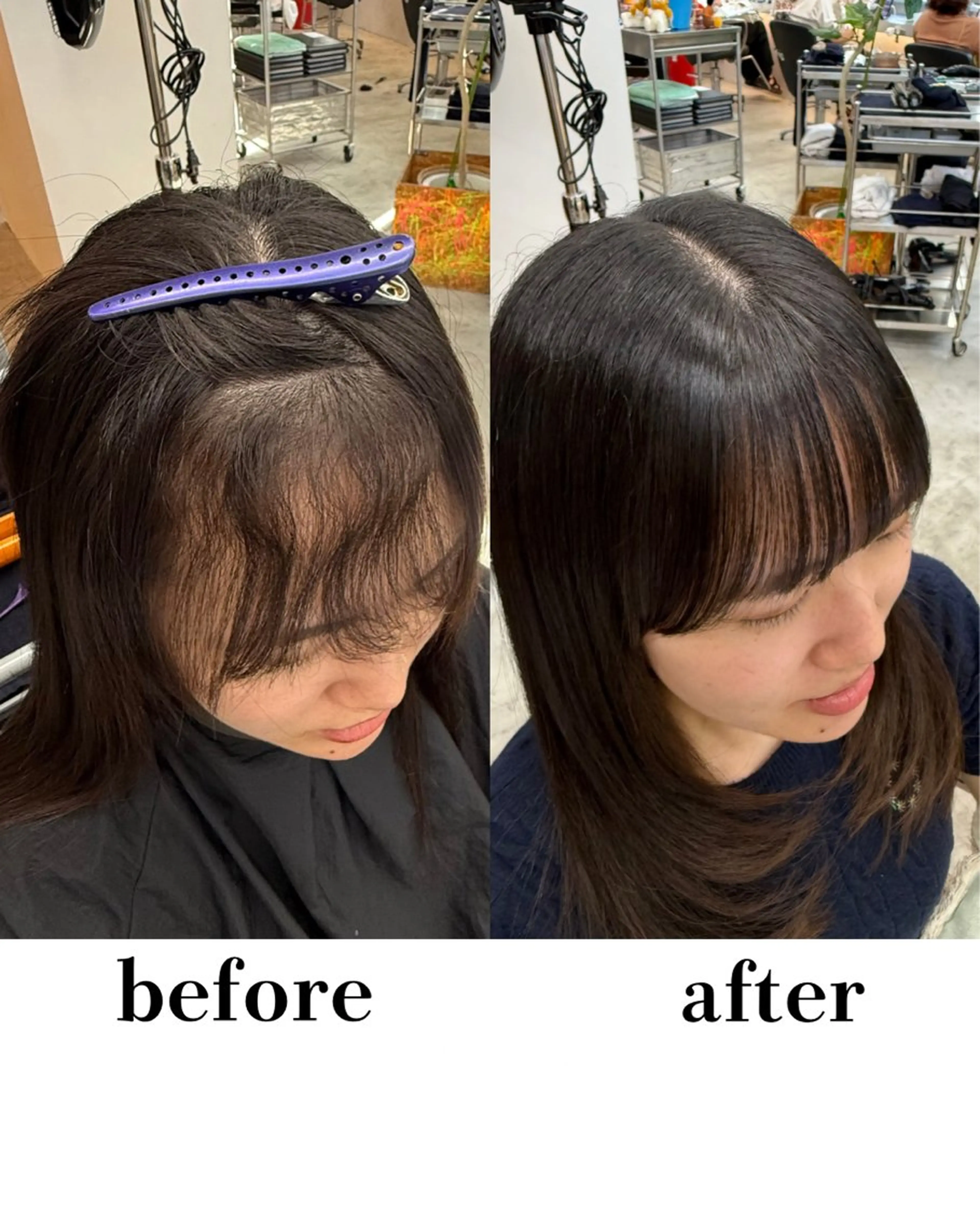 【はえ癖も直せる❗️】前髪縮毛矯正＋3stepトリートメントの写真